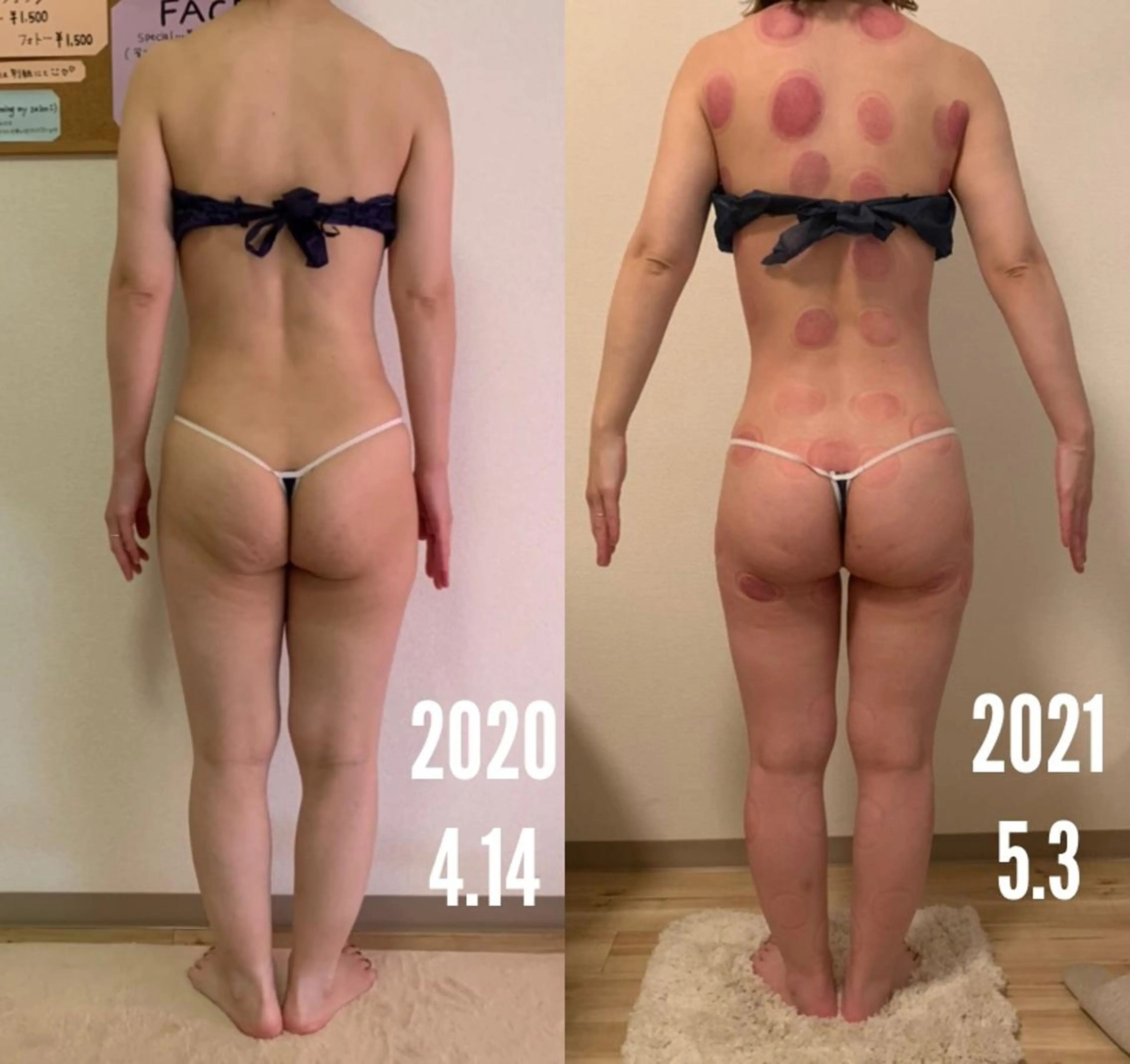 a  room salonのエステ・リラクイメージ