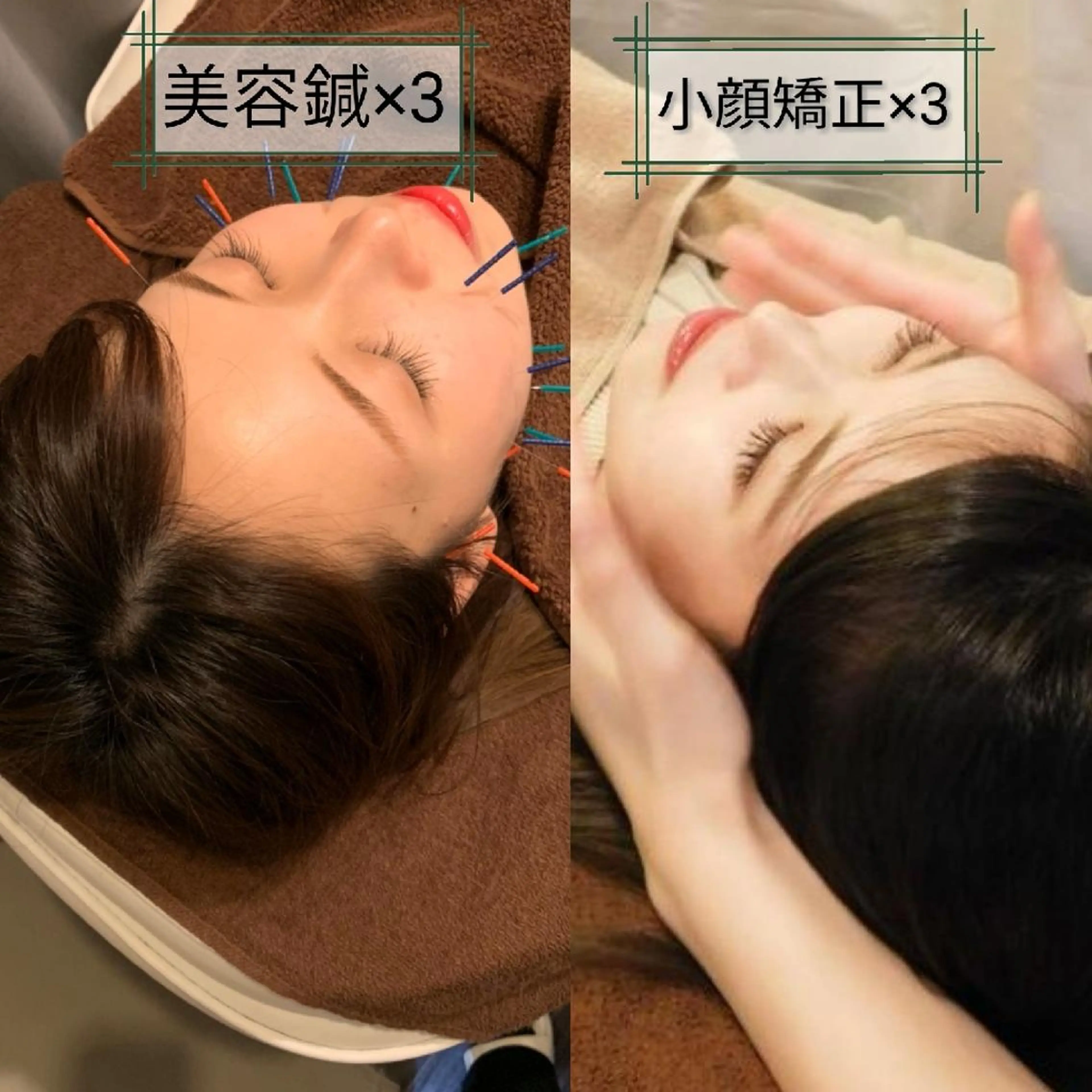 たるみ専門美容鍼 × 猫背整体 のぐち所属・小顔と姿勢改善のプロ ｜整体と美容鍼のぐちのエステ・リラクイメージ