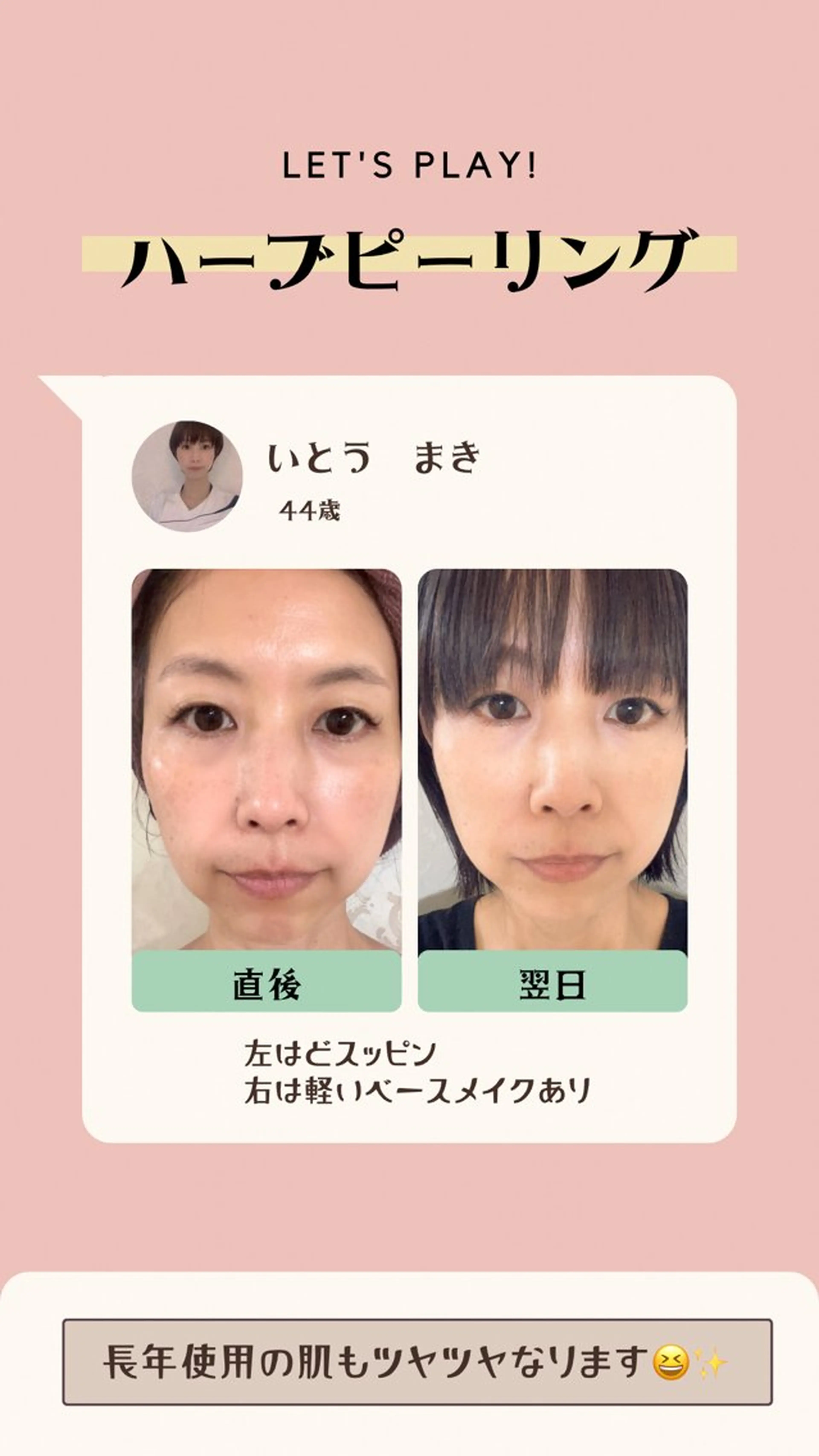 山本 寛美のその他イメージ