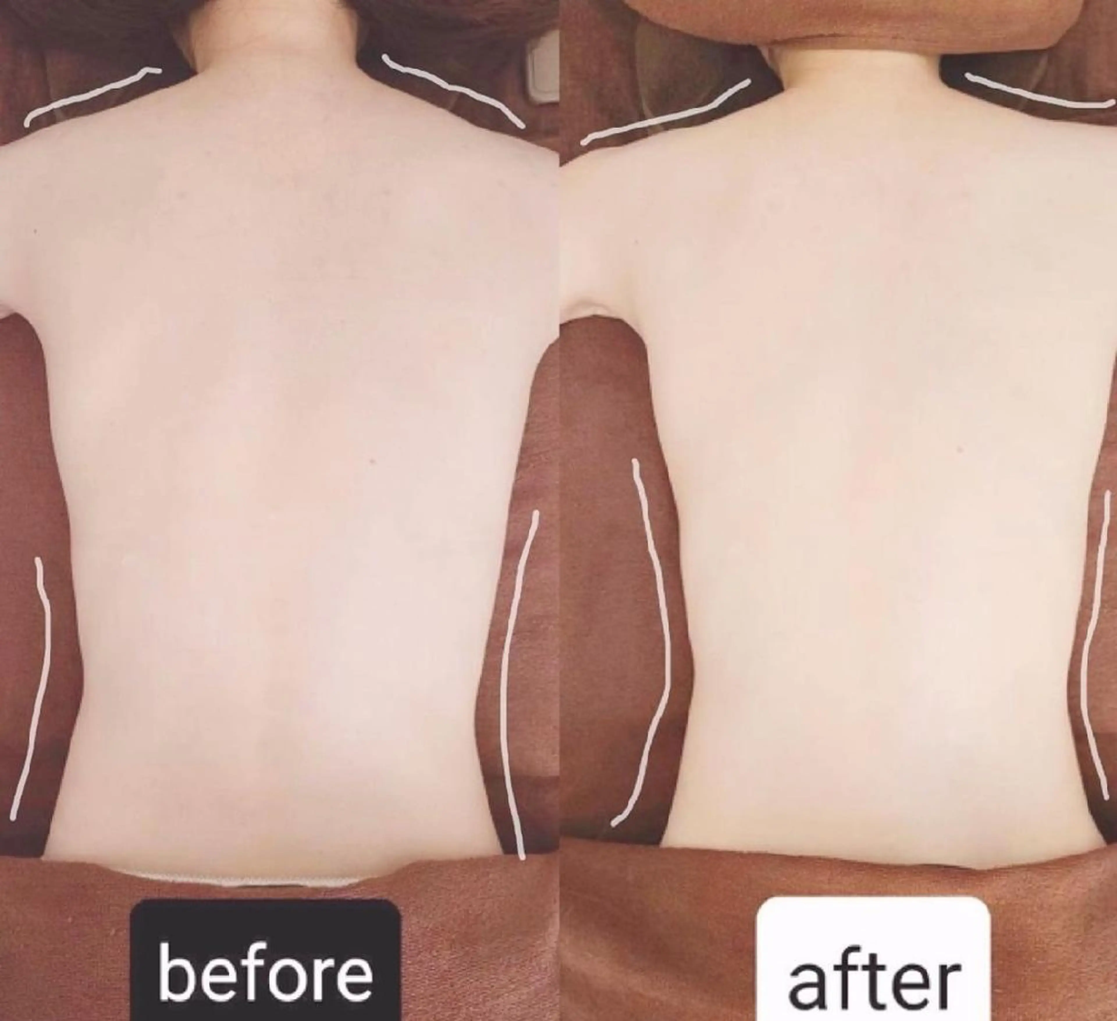 ☆お試し☆癒されながらW痩身!炭酸×キャビテーション60分¥15000→¥10000の写真