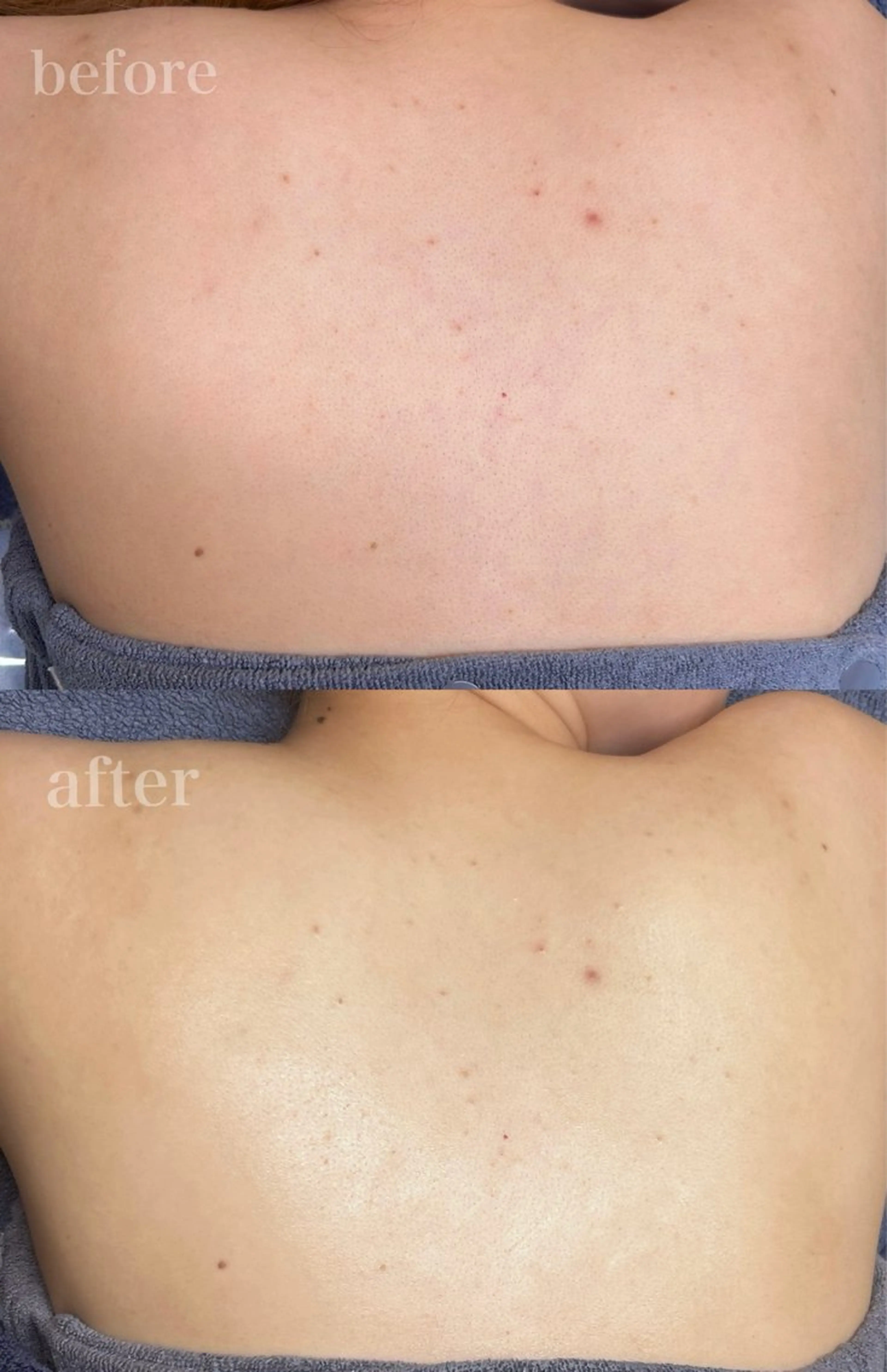 エステ リラク Le cherienのエステ・リラクイメージ