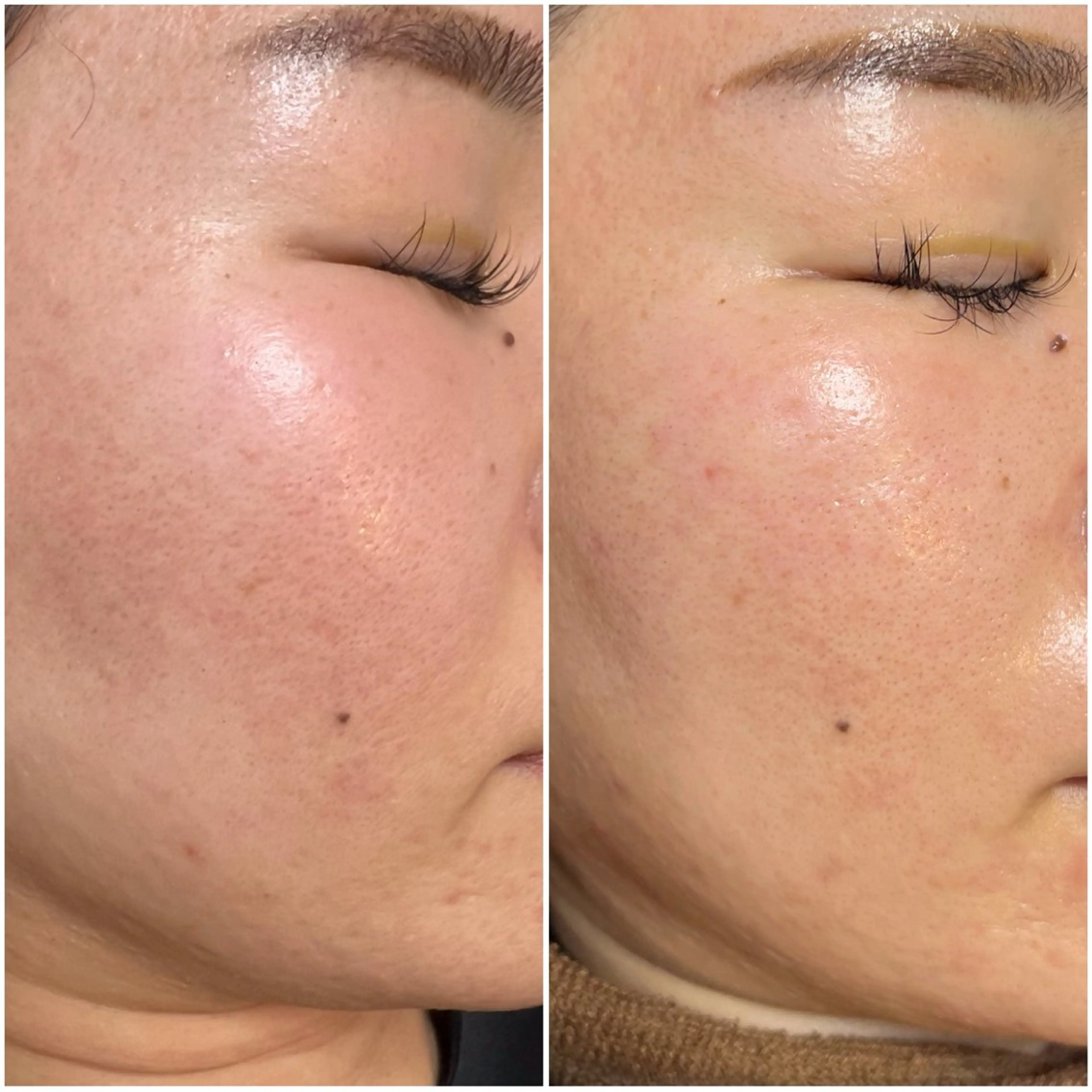 都度払い脱毛 BARNEYのエステ・リラクイメージ