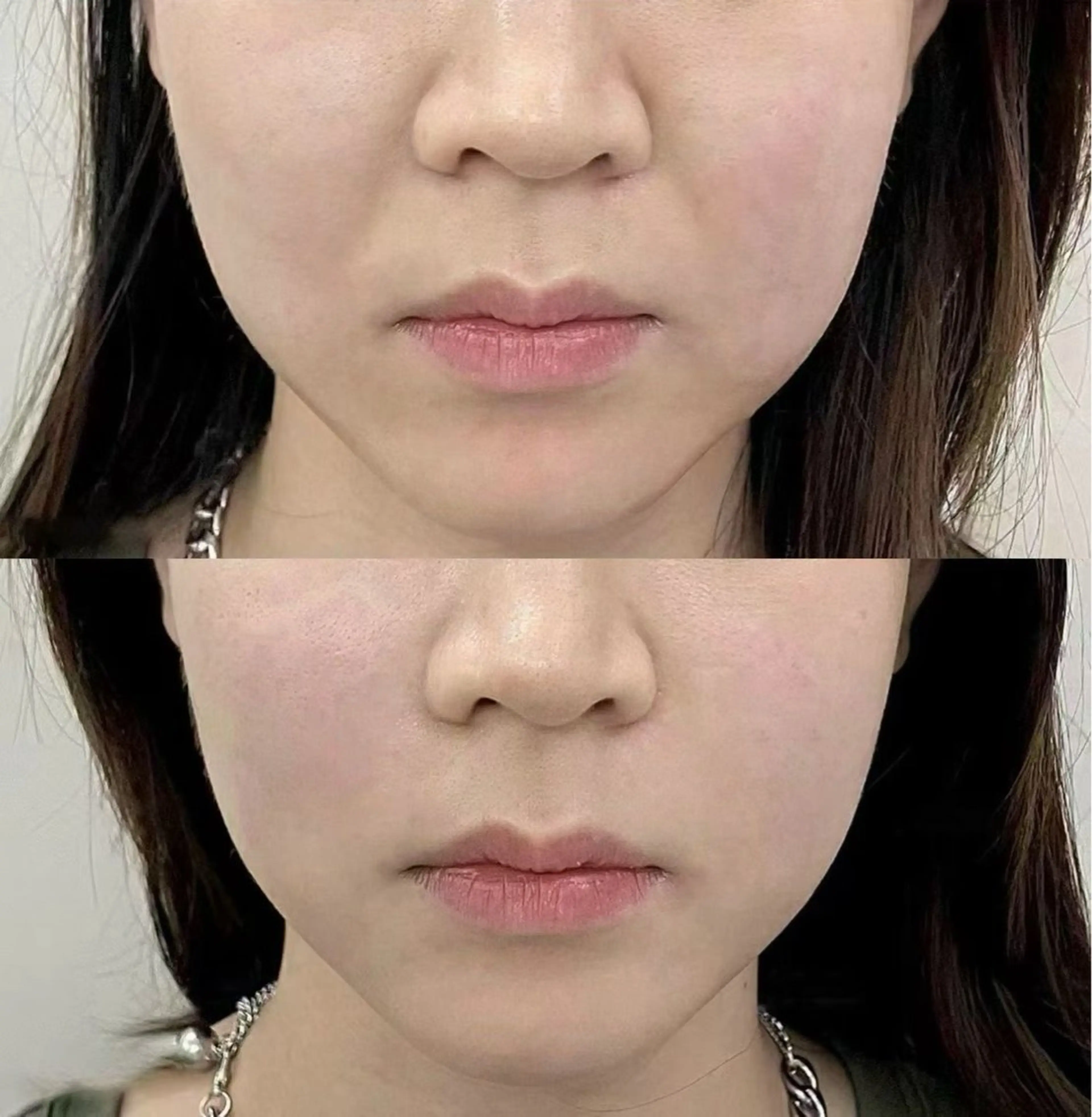 ネイル エステ aliaハイフ&水光ジェットサロン所属・aliaハーブ水光店 エステティシャン募集のエステ・リラクイメージ