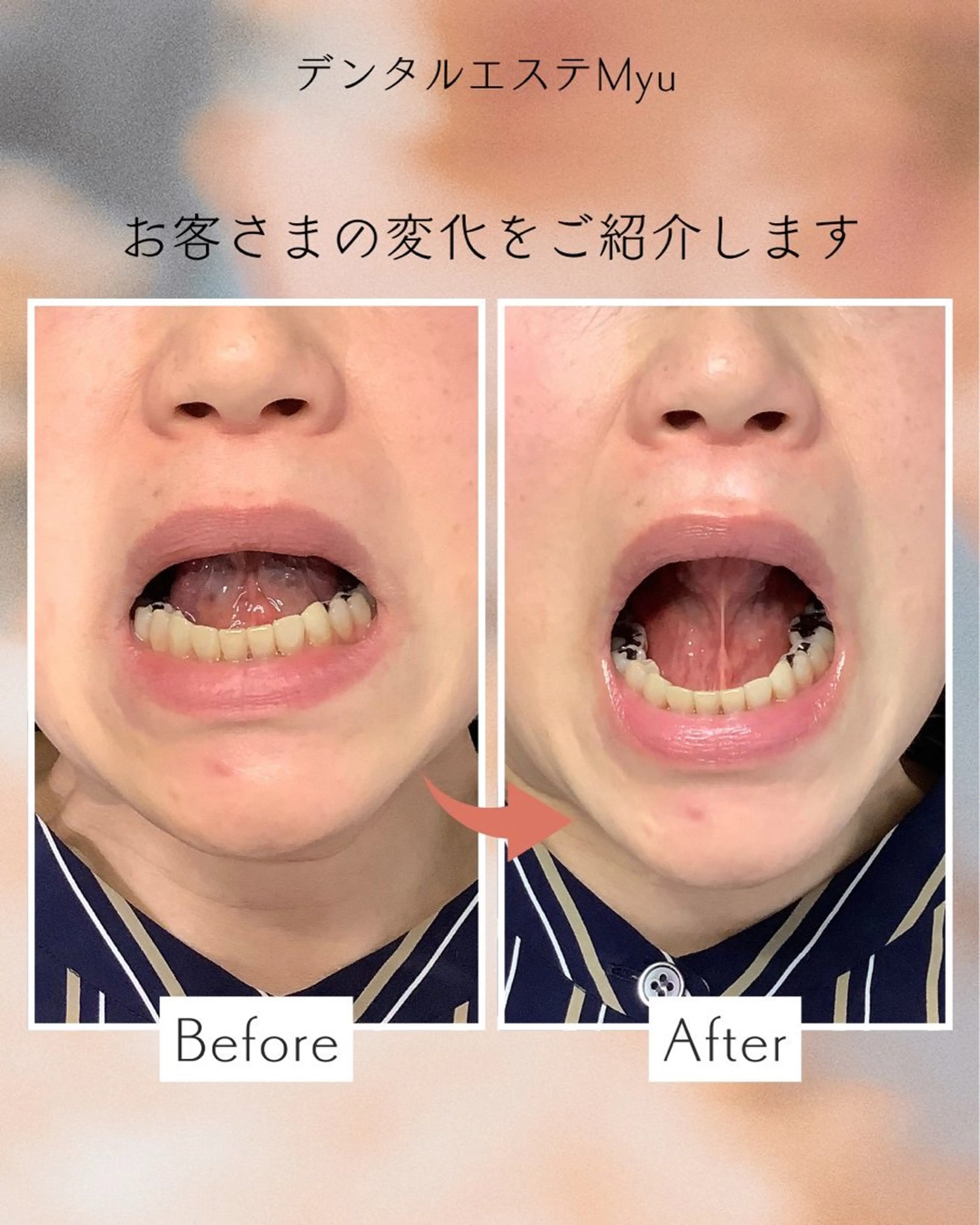 エステ Myu所属・Suzuki Yumiのエステ・リラクイメージ