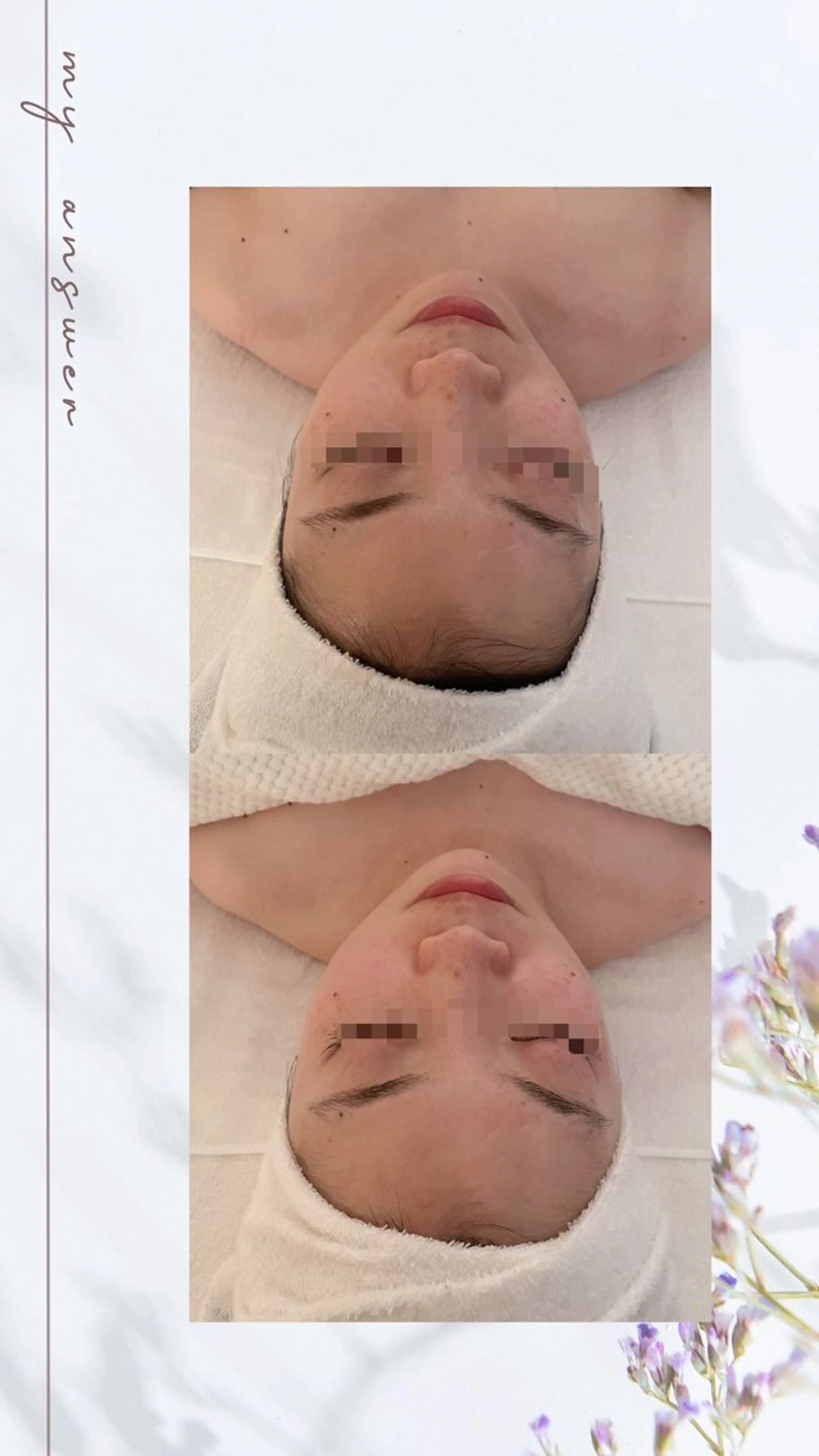 小顔/リンパ/マッサージL.sana所属・小顔/フェイシャル L.sanaのエステ・リラクイメージ