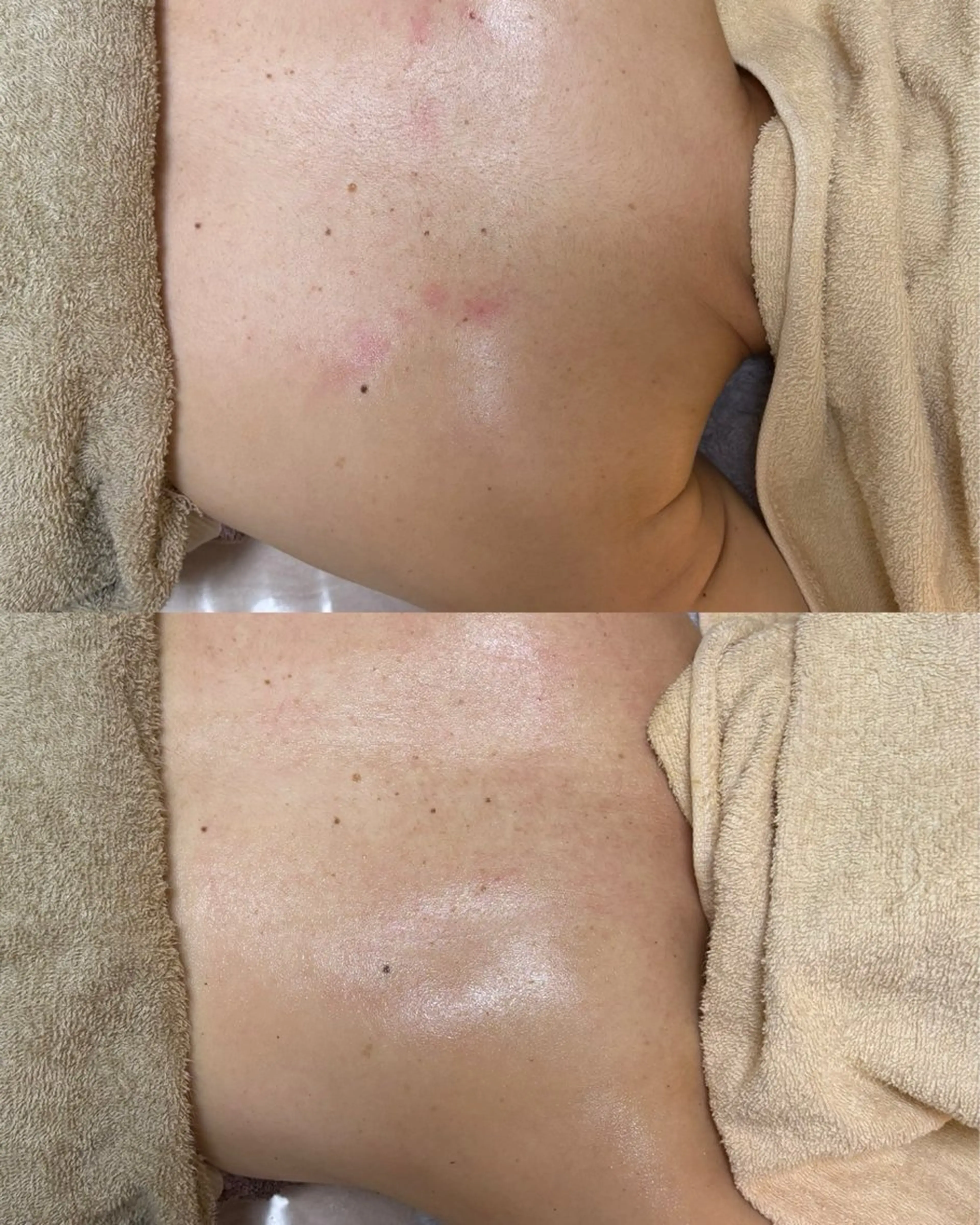 肌質改善専門サロンAte国分寺店所属・Ate Rikaのエステ・リラクイメージ