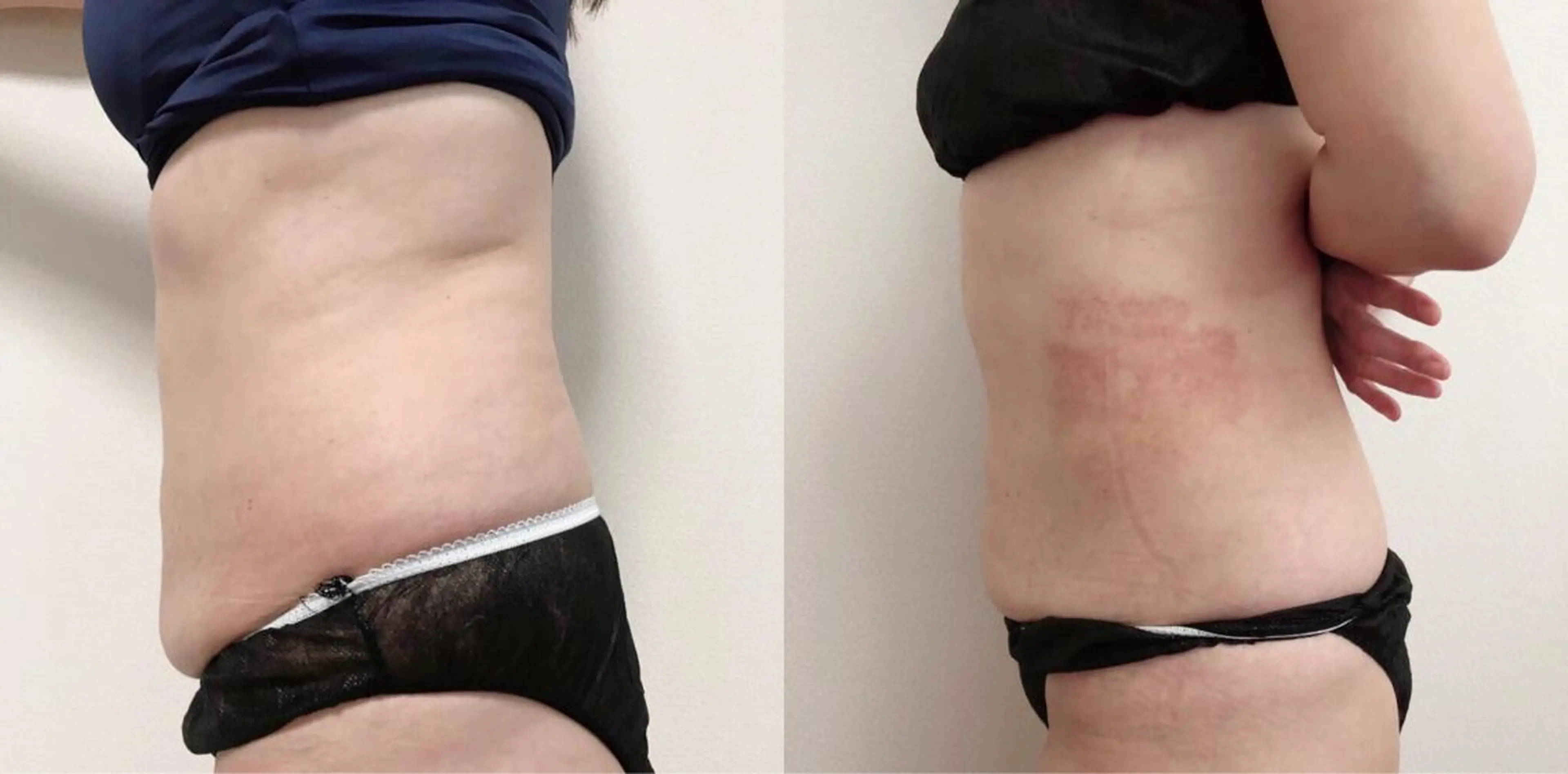 エステ Rainbow 仙台のエステ・リラクイメージ