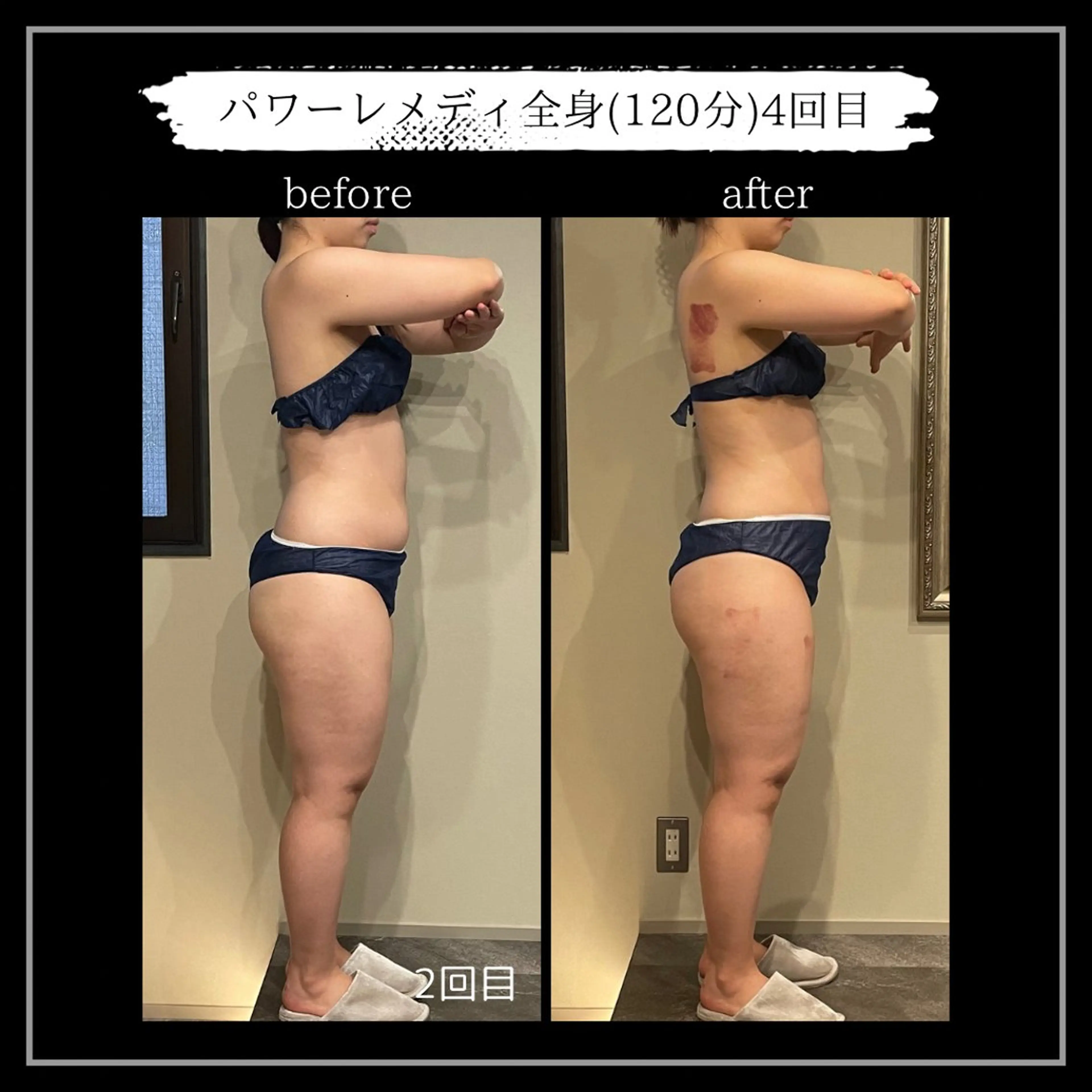 オフ:オン所属・オフ:オン 全身筋膜マッサージのエステ・リラクイメージ