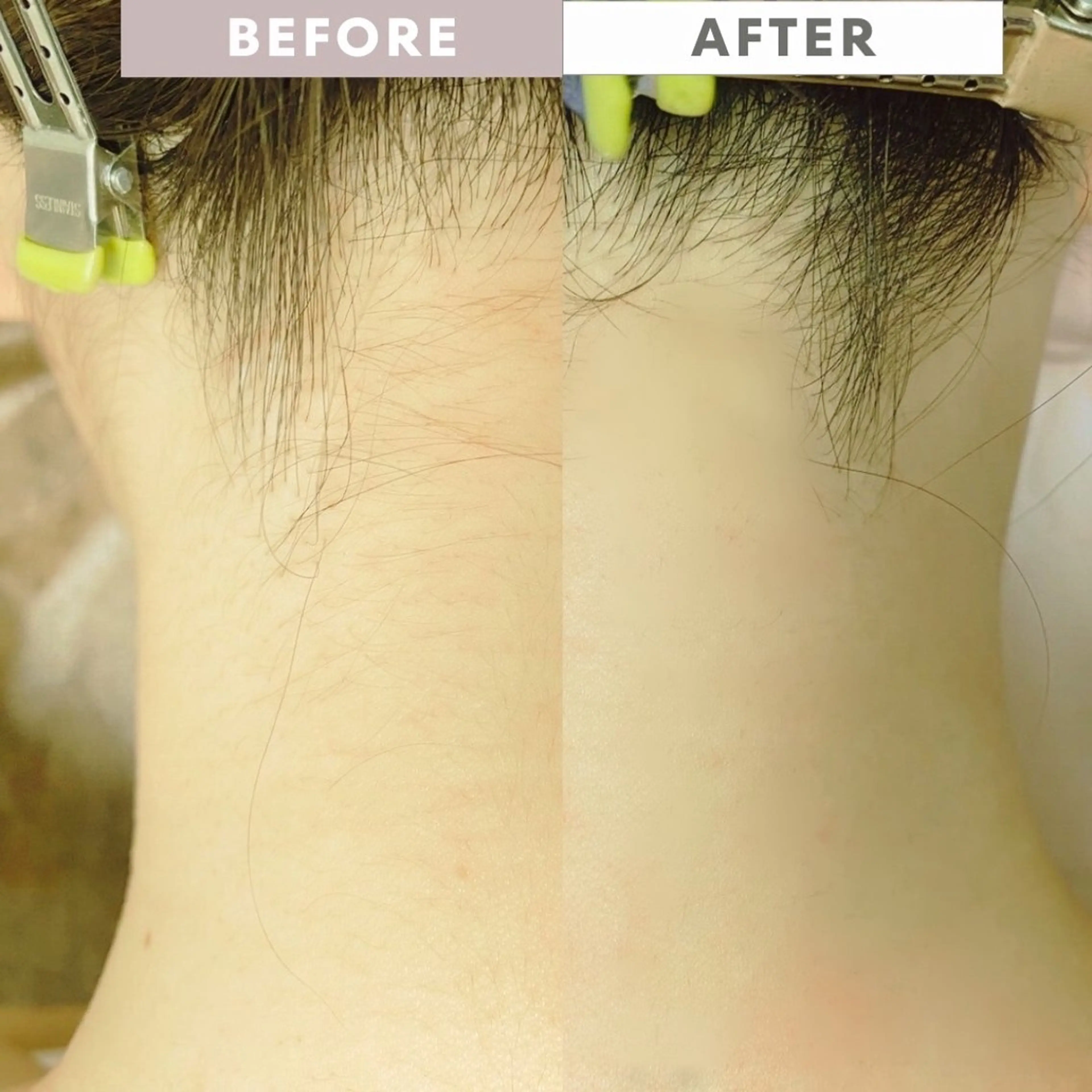 脱毛 sugaring salon Malo所属・シュガーリングサロン Maloのエステ・リラクイメージ