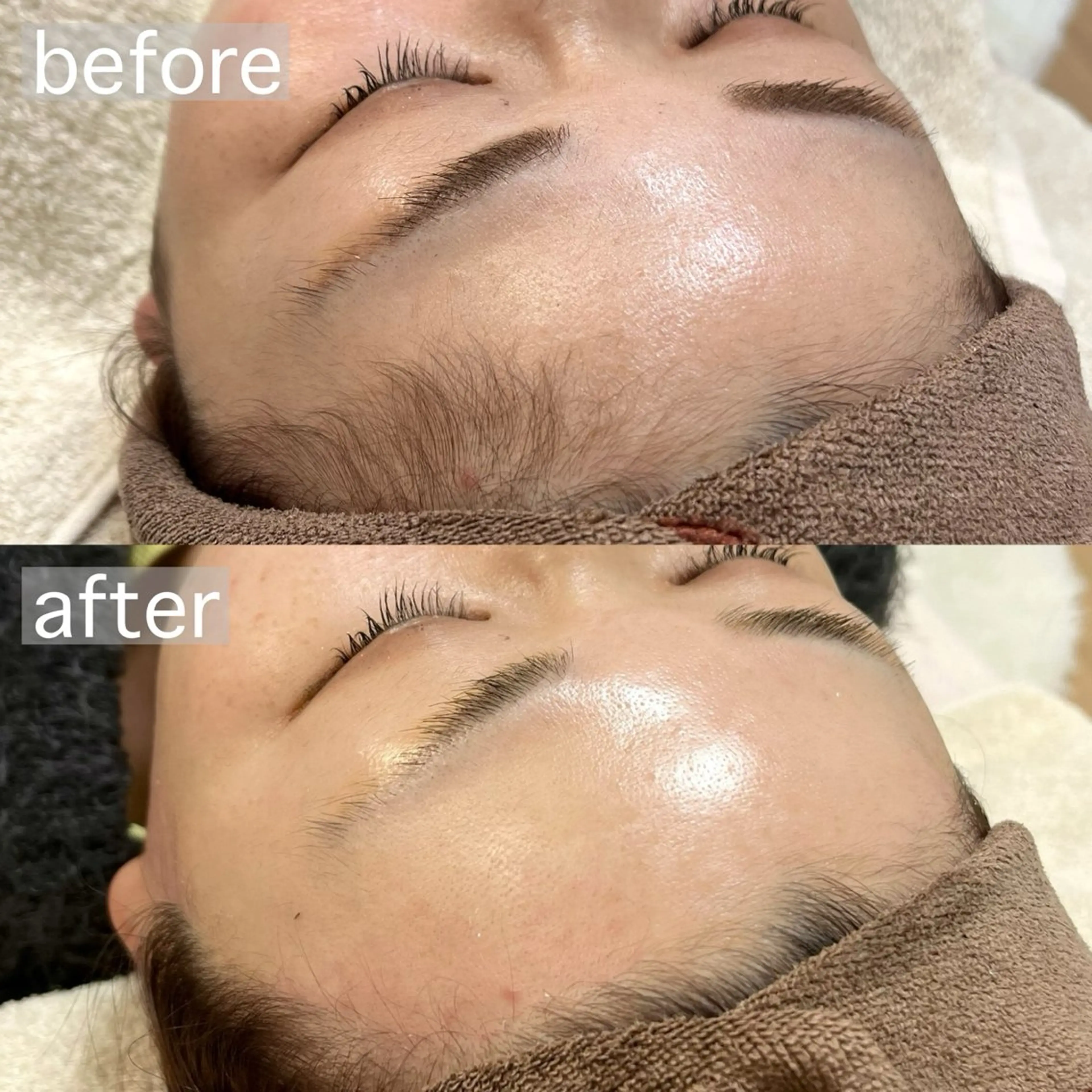 アイブロウ&フェイシャルサロンa‘lm所属・WAX脱毛/肌質改善 眉毛とお肌のサロンのエステ・リラクイメージ