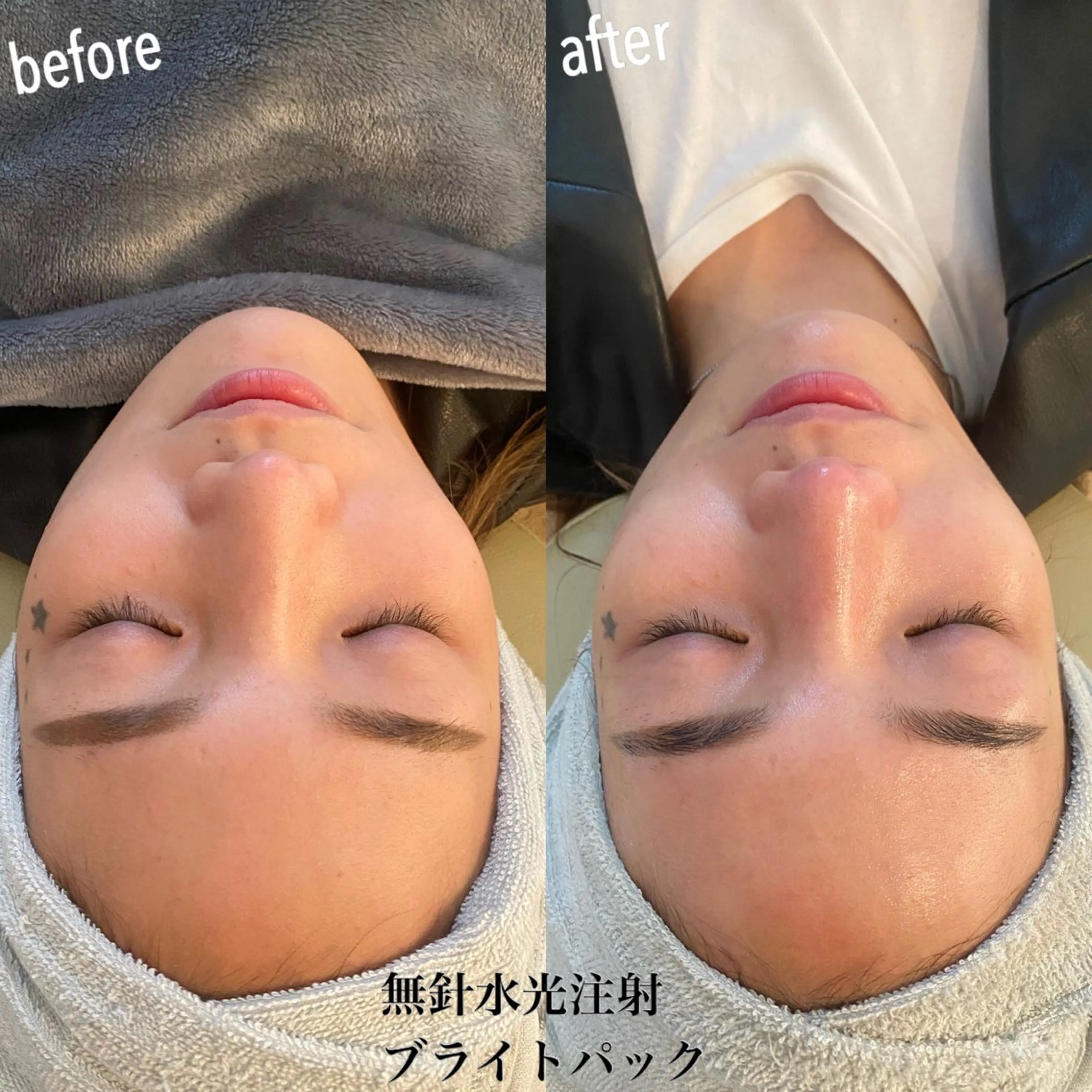 エステ リラク うなじ脱毛/美肌脱毛 LABELのエステ・リラクイメージ