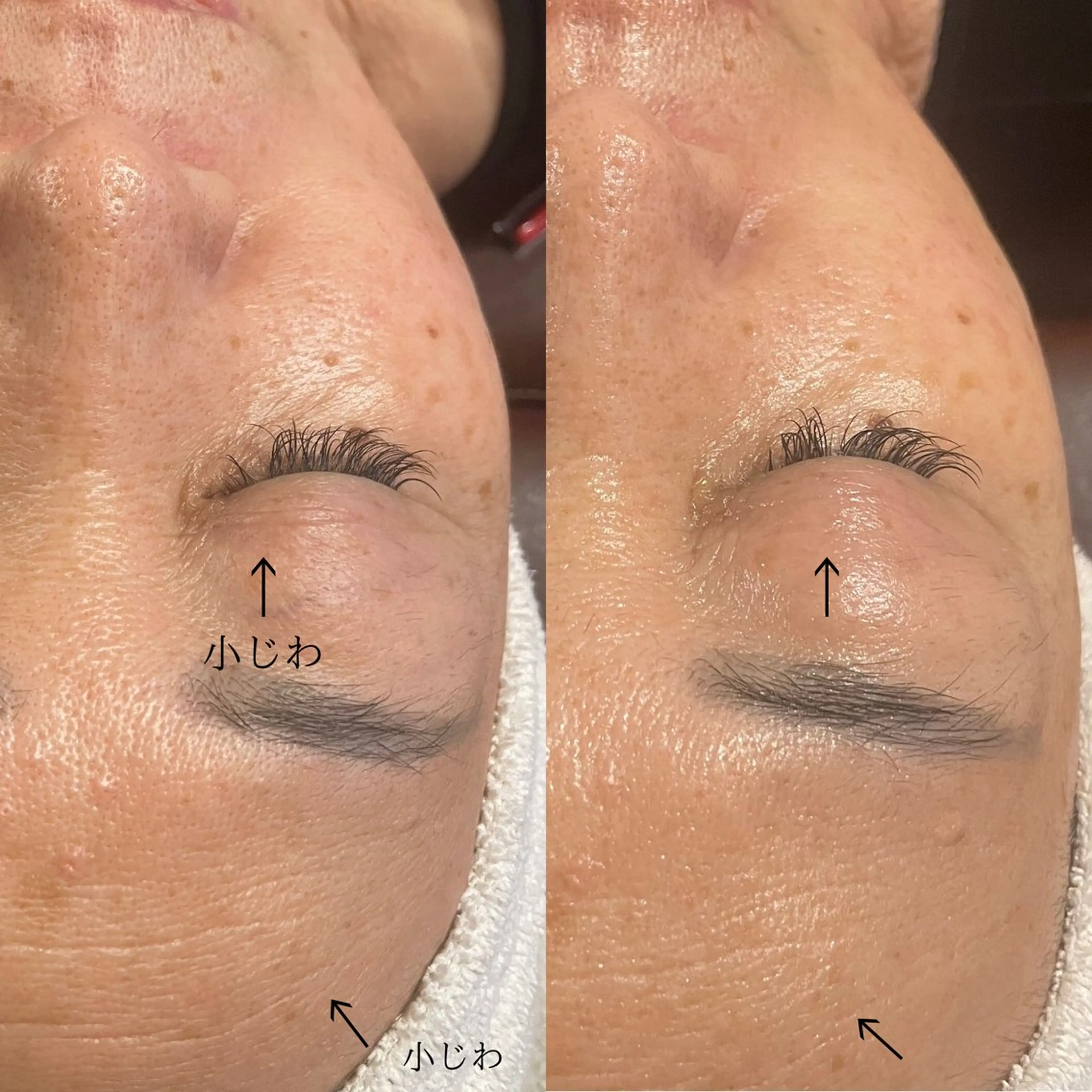 メンズ Amm所属・🏆艶肌ワックス🏆 ララピール✨Ammのエステ・リラクイメージ