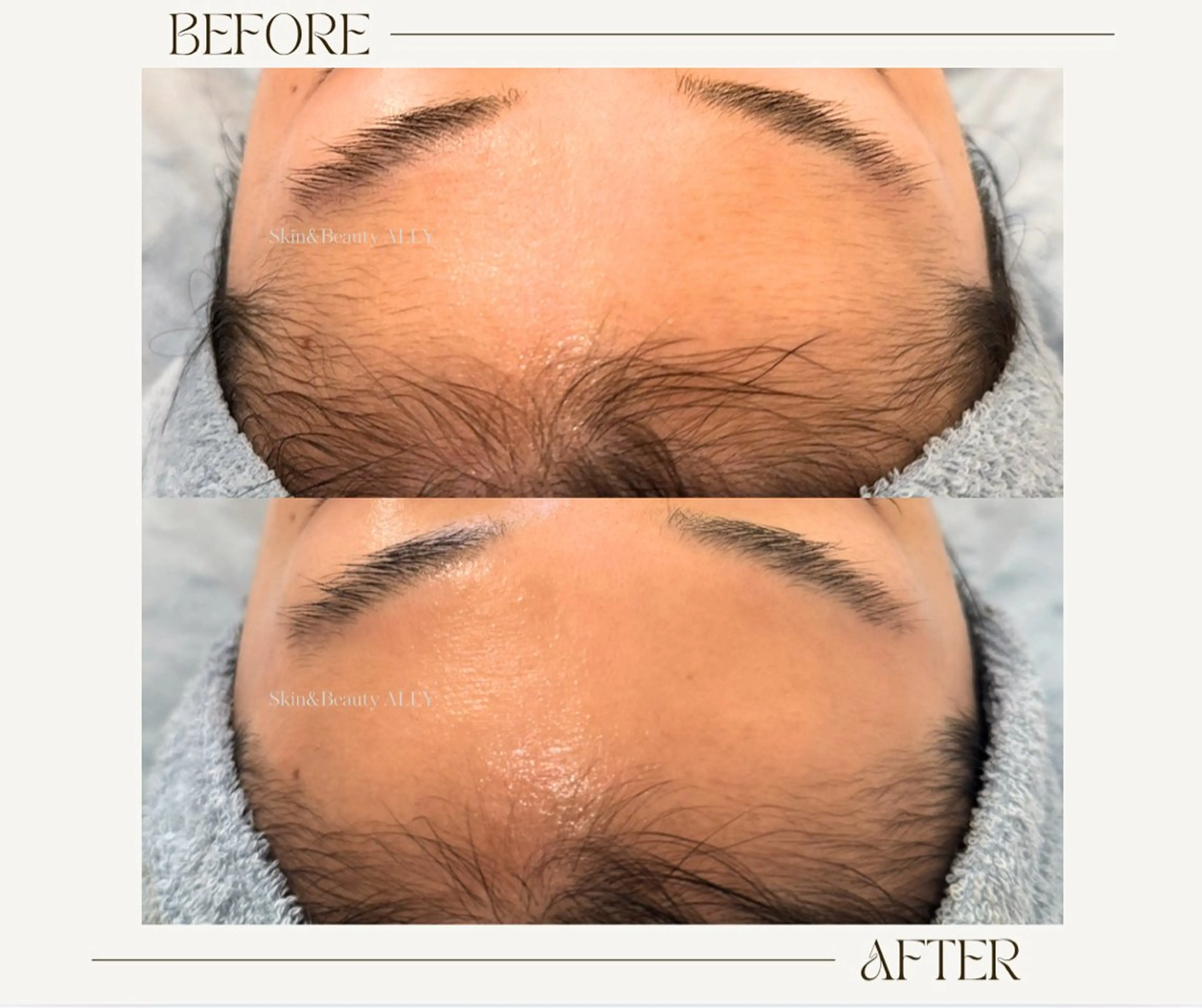 エステ 艶肌ワックス ALLY.のエステ・リラクイメージ