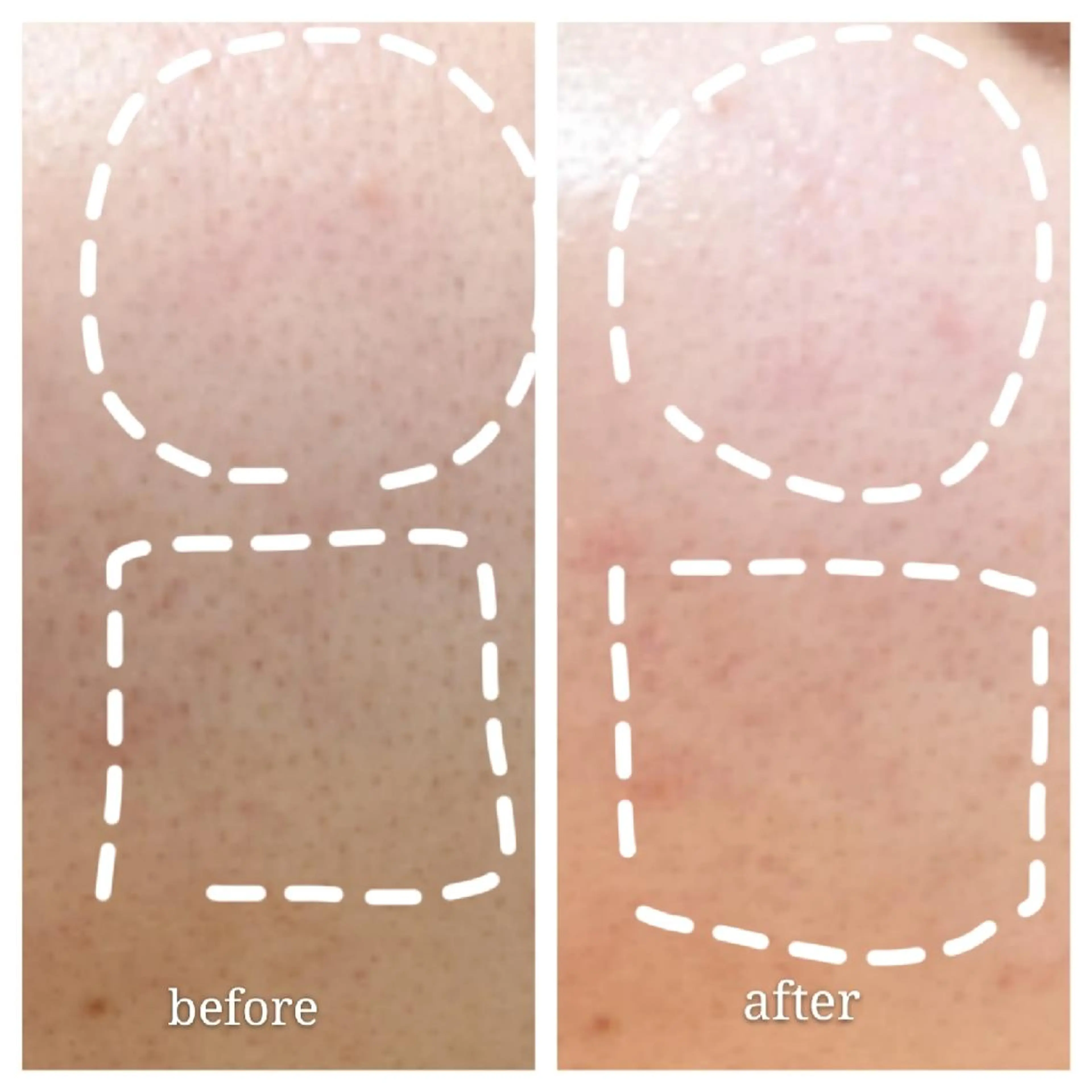 🅖🅤🅩🅔🅛 salonのエステ・リラクイメージ