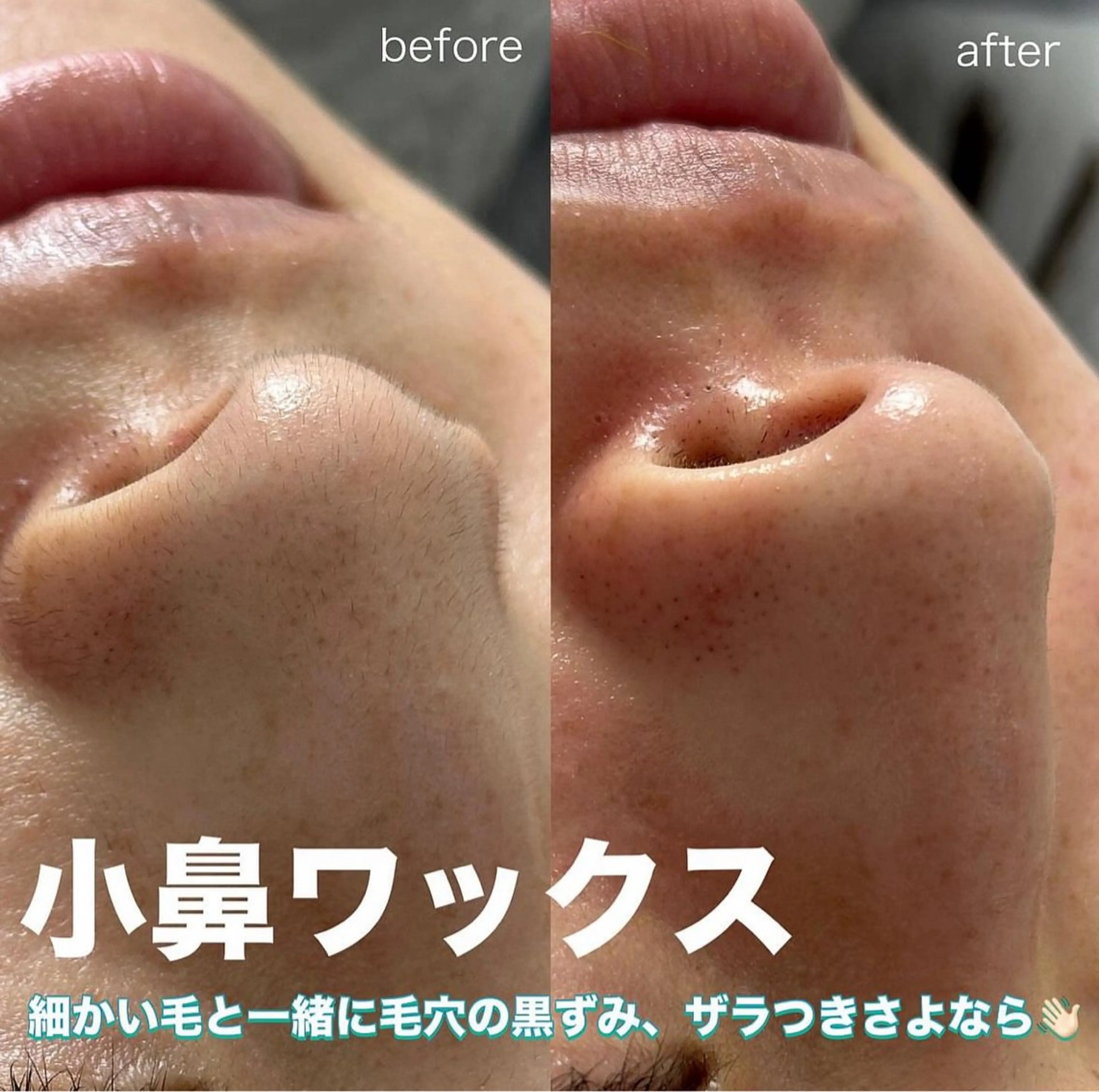 サニーヒルズ藤沢 HARUMIの眉毛・アイブロウイメージ