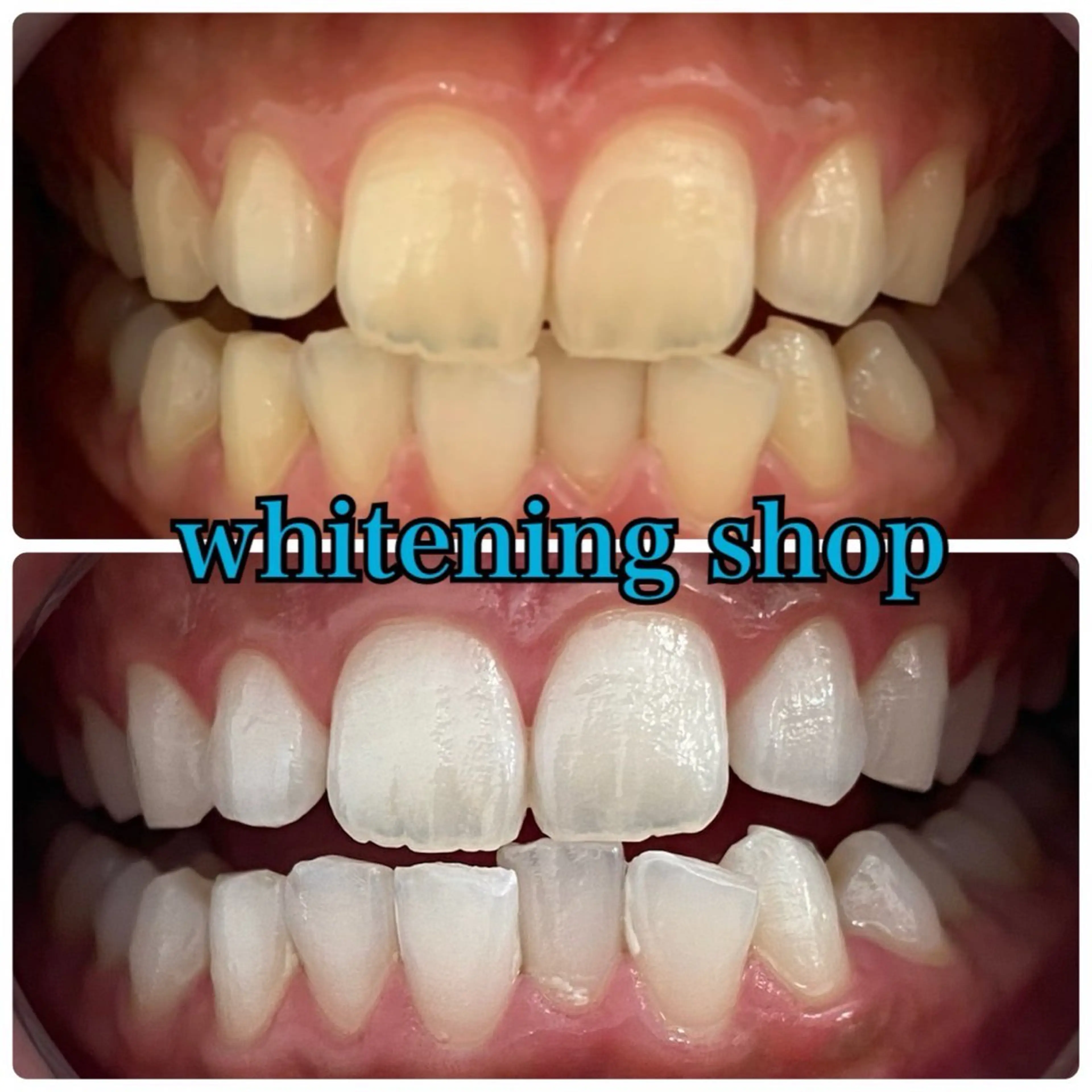 メンズ エステ リラク ホワイトニング ショップ川越店のエステ・リラクイメージ