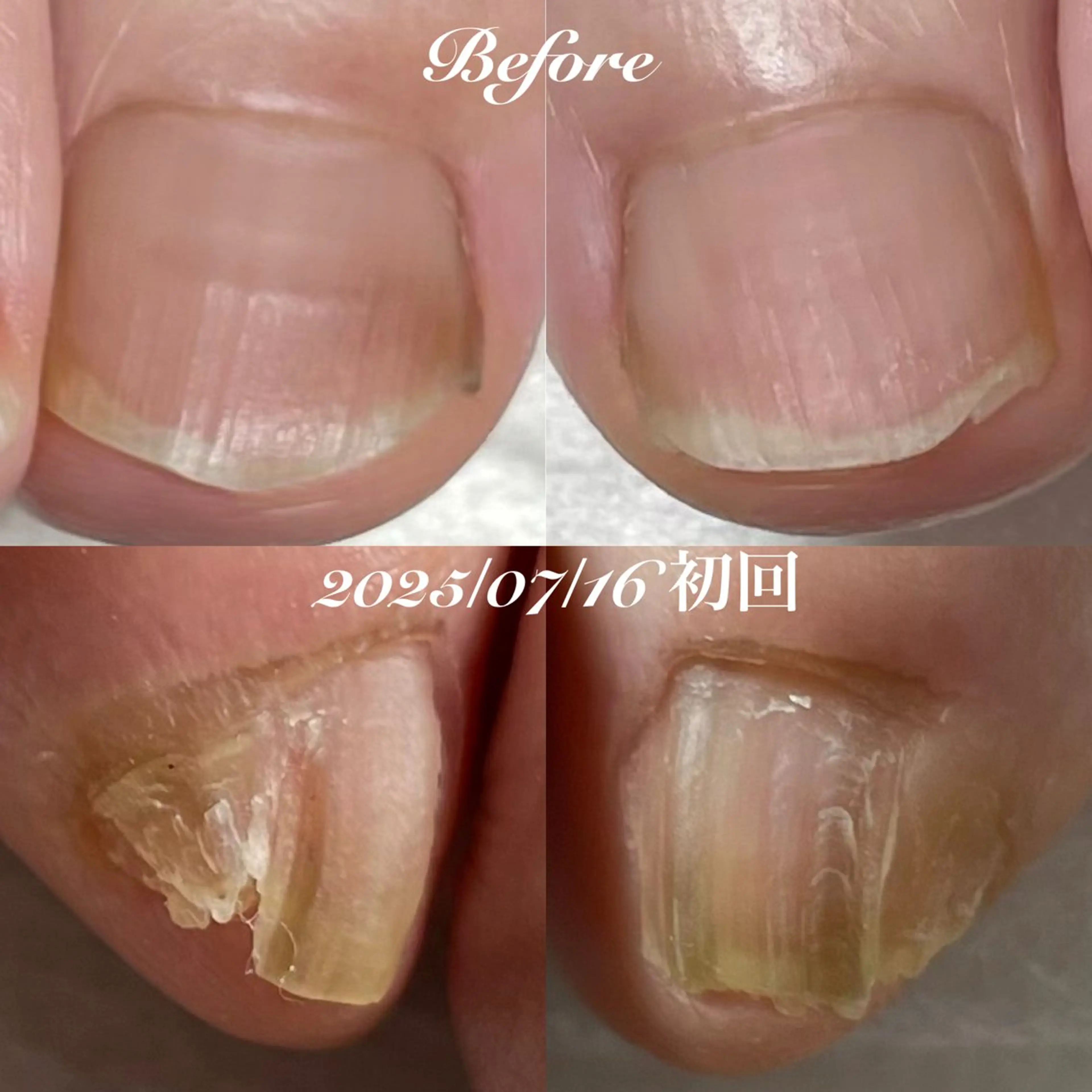 ネイル フットネイル 赤色 .Nails Mio 赤羽西ネイルサロンのネイルデザイン