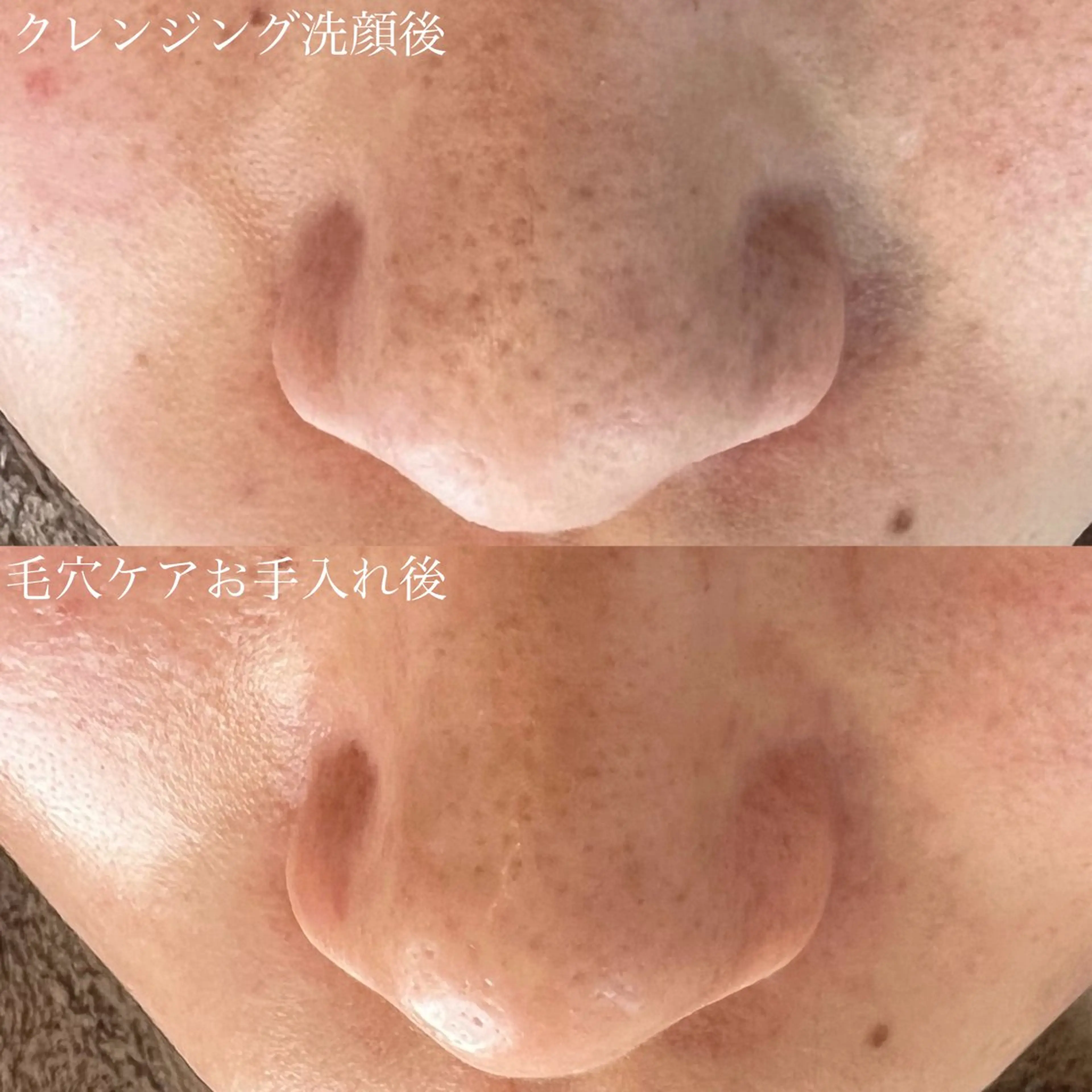エステ Luana  アイラッシュ& フェイシャル所属・Luana eyelashのマツエク・マツパデザイン