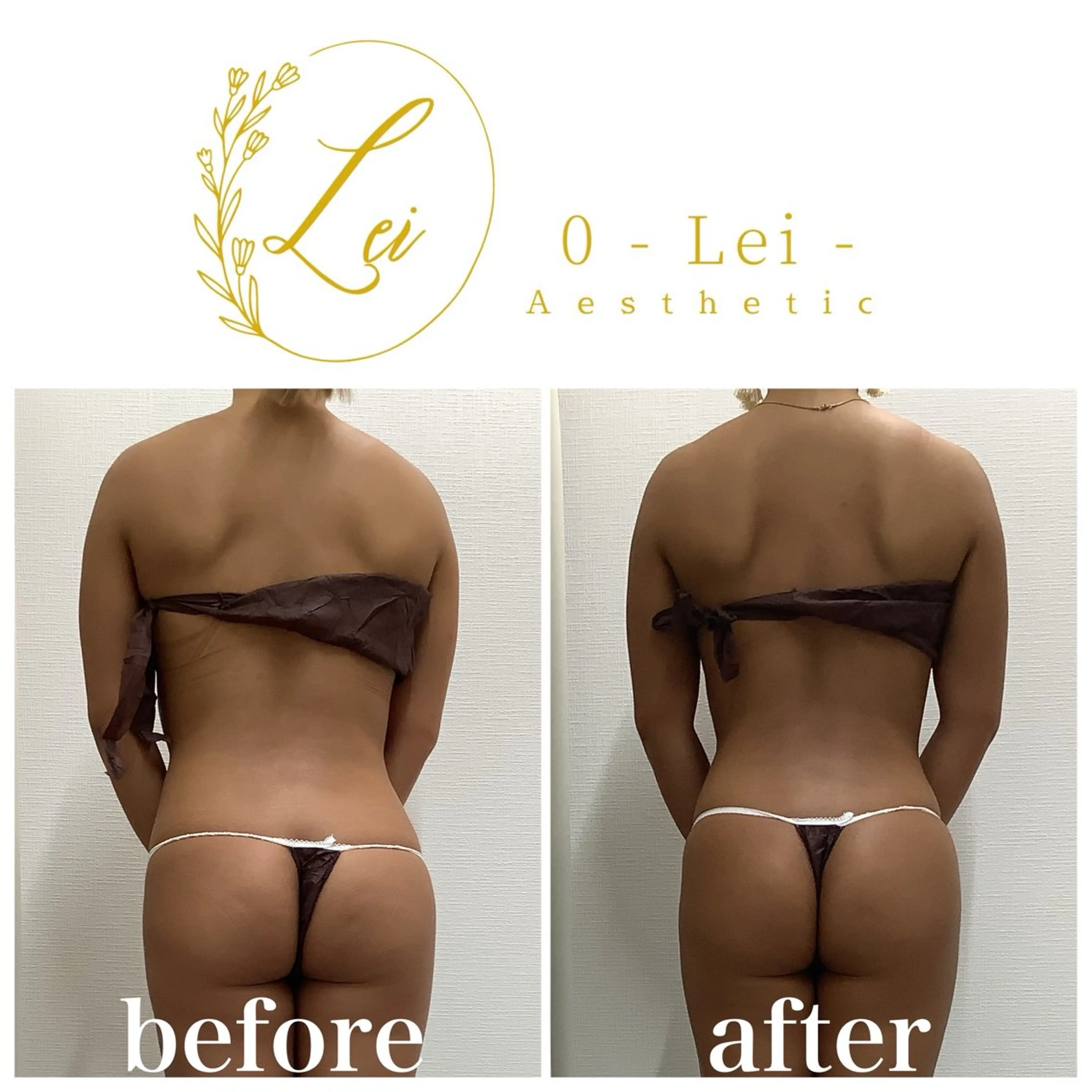 エステ 0-Lei-aesthetic所属・レイエステティック スタッフのエステ・リラクイメージ