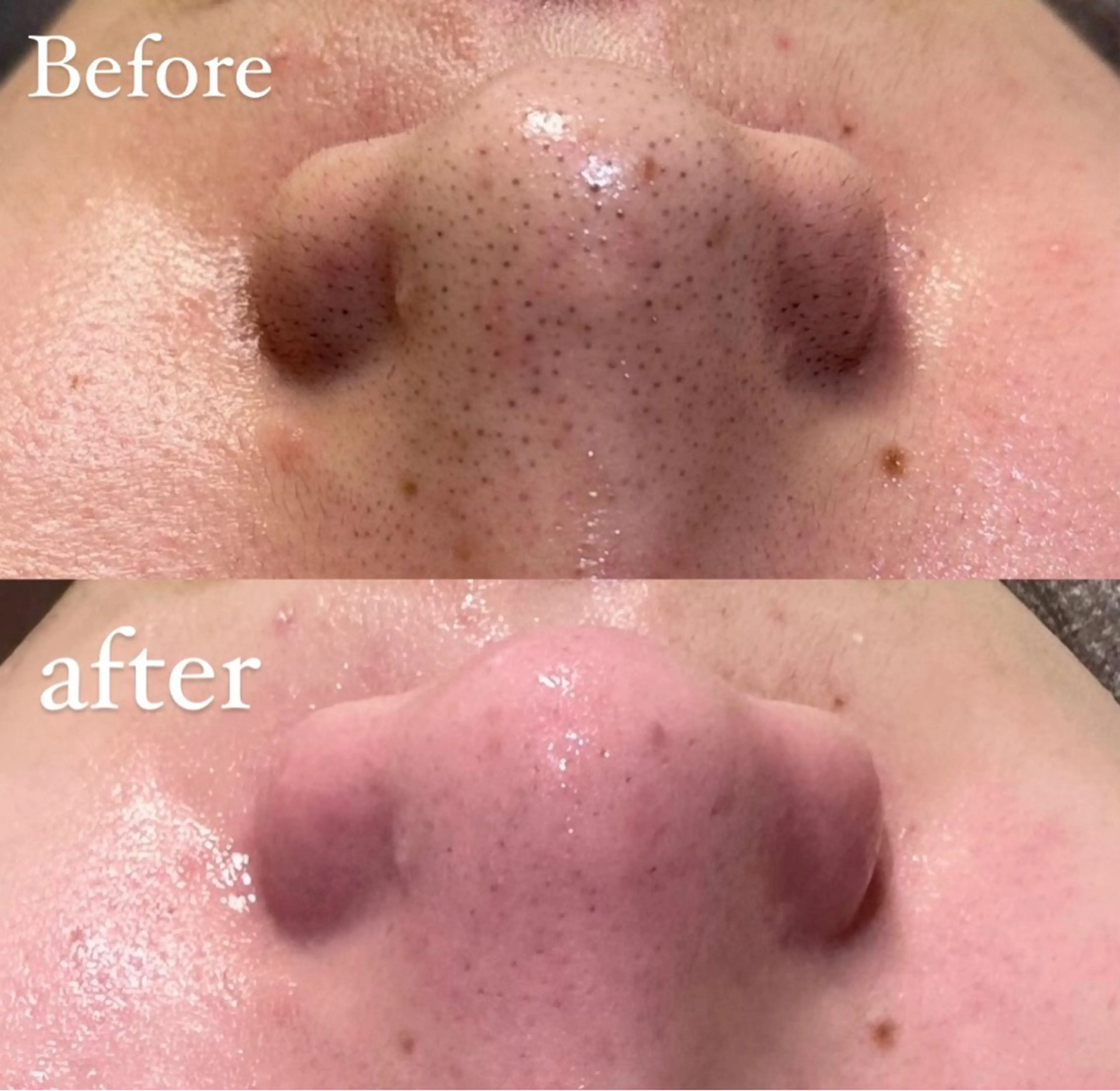 HINA/産毛脱毛・ 肌質改善専門サロンのエステ・リラクイメージ