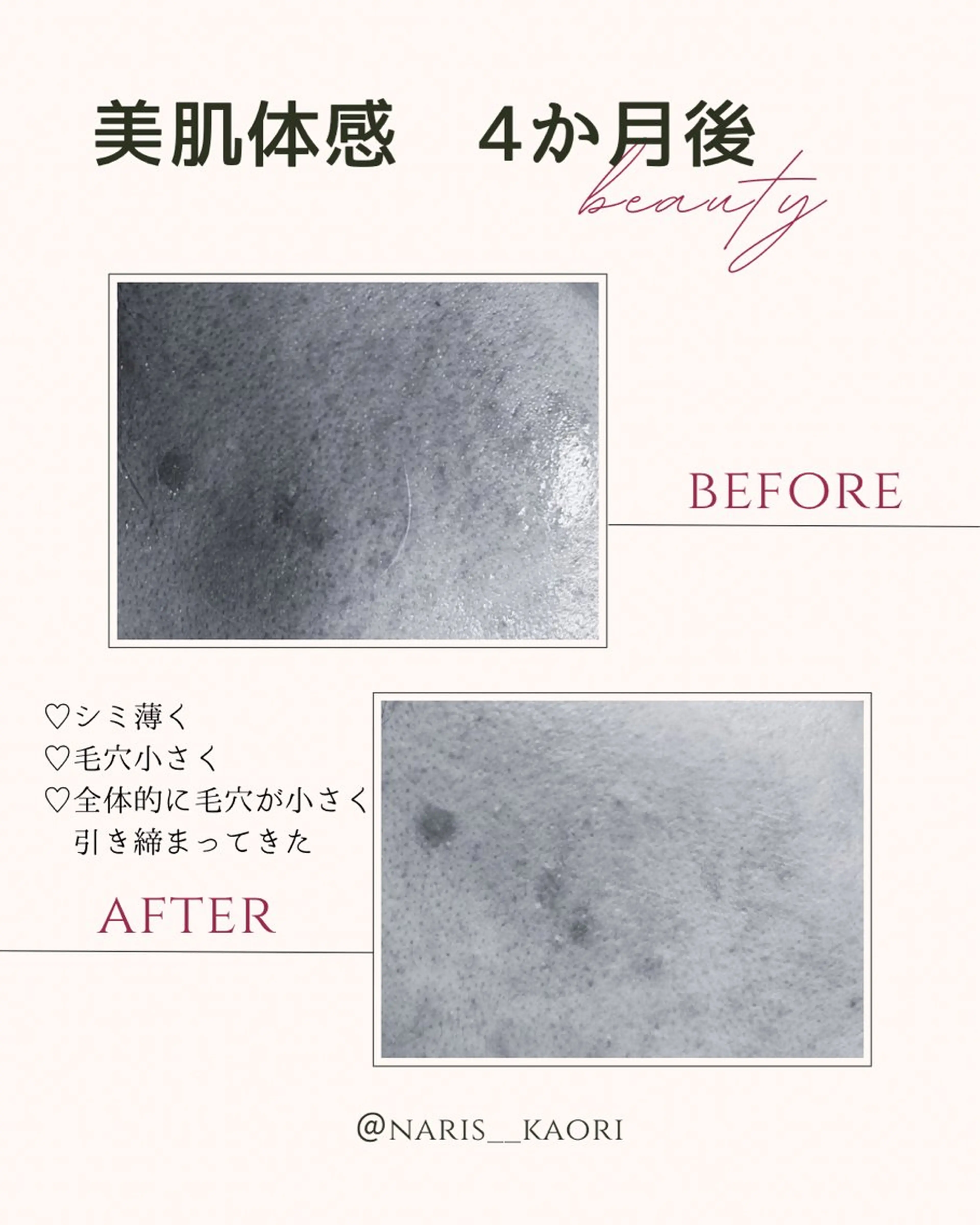 エステ フェイシャルエステ♡ KAORIのエステ・リラクイメージ