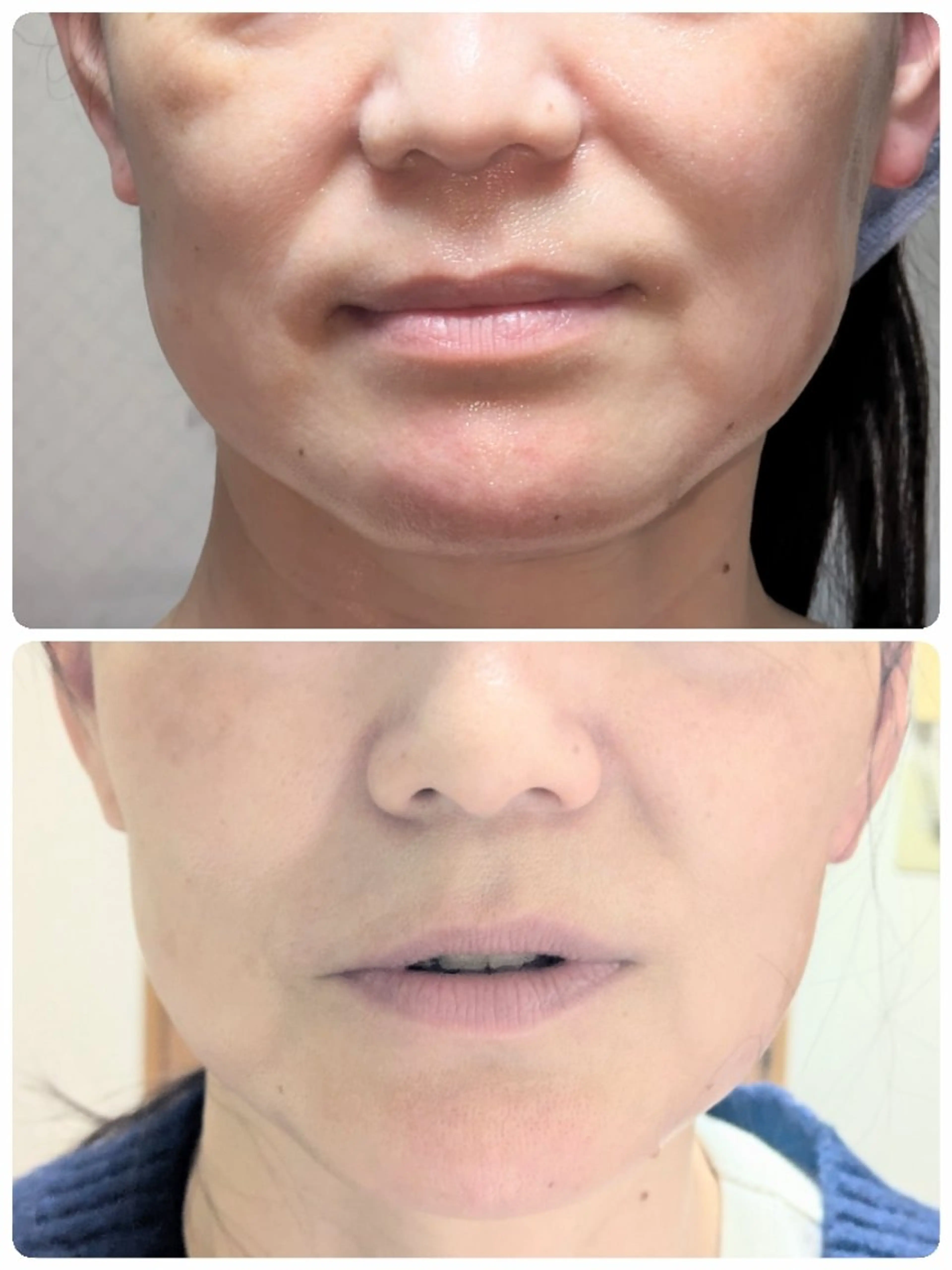 フェイシャルエステ アンソン・ドゥのエステ・リラクイメージ