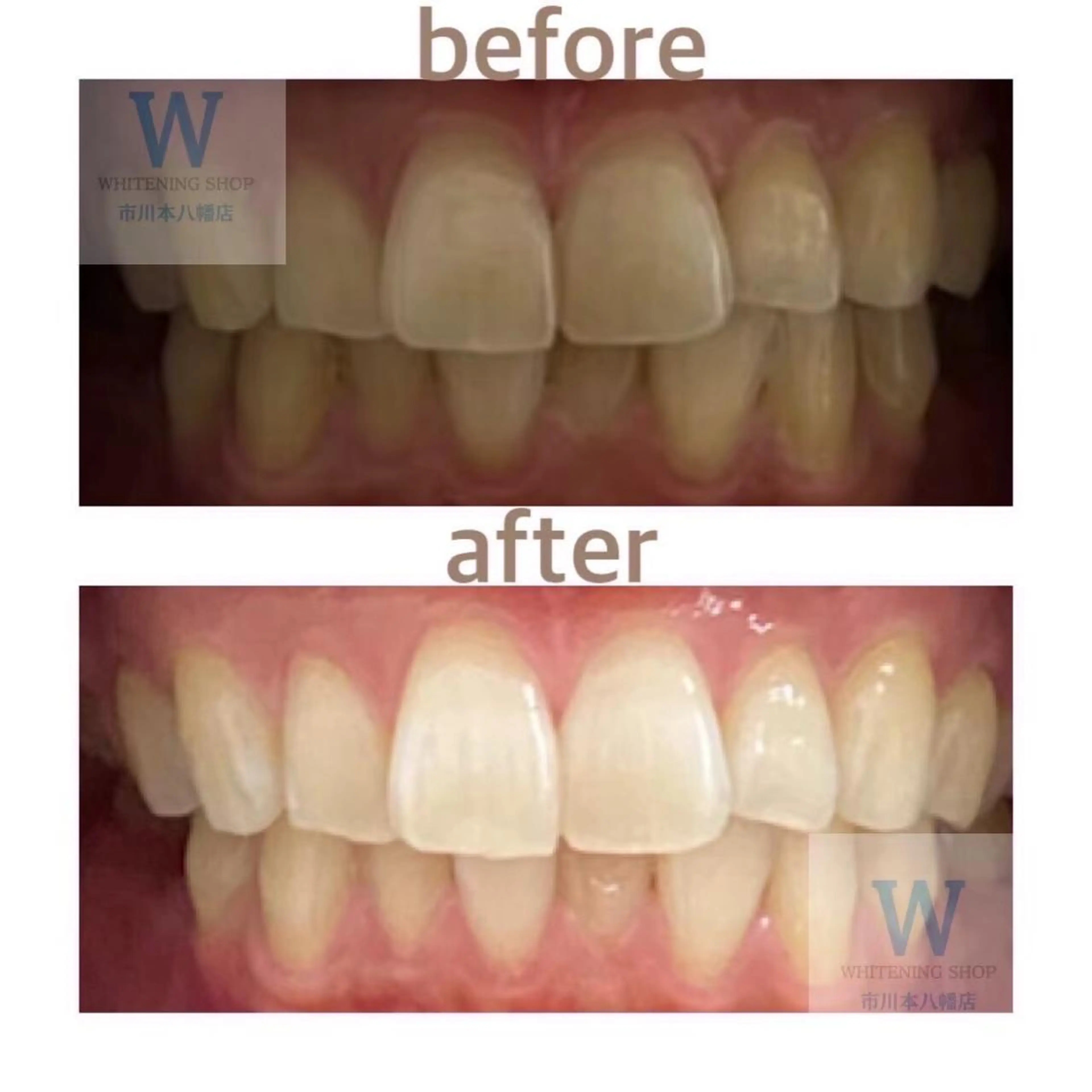 ホワイトニング ショップ本八幡店のエステ・リラクイメージ