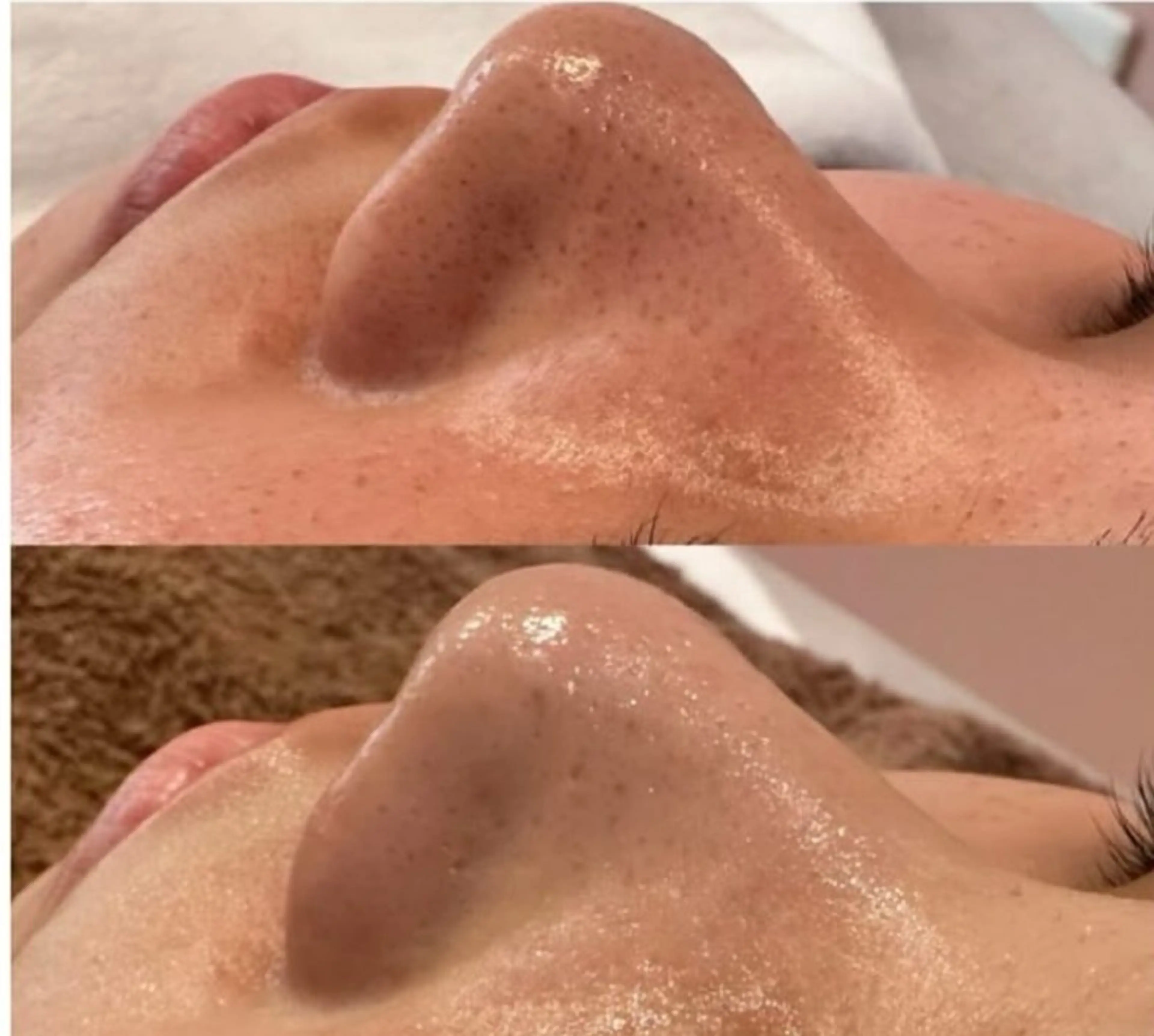 エイジングケアサロンBIOEL所属・肌質改善BIOELプ ラズマ/ラミピールのエステ・リラクイメージ