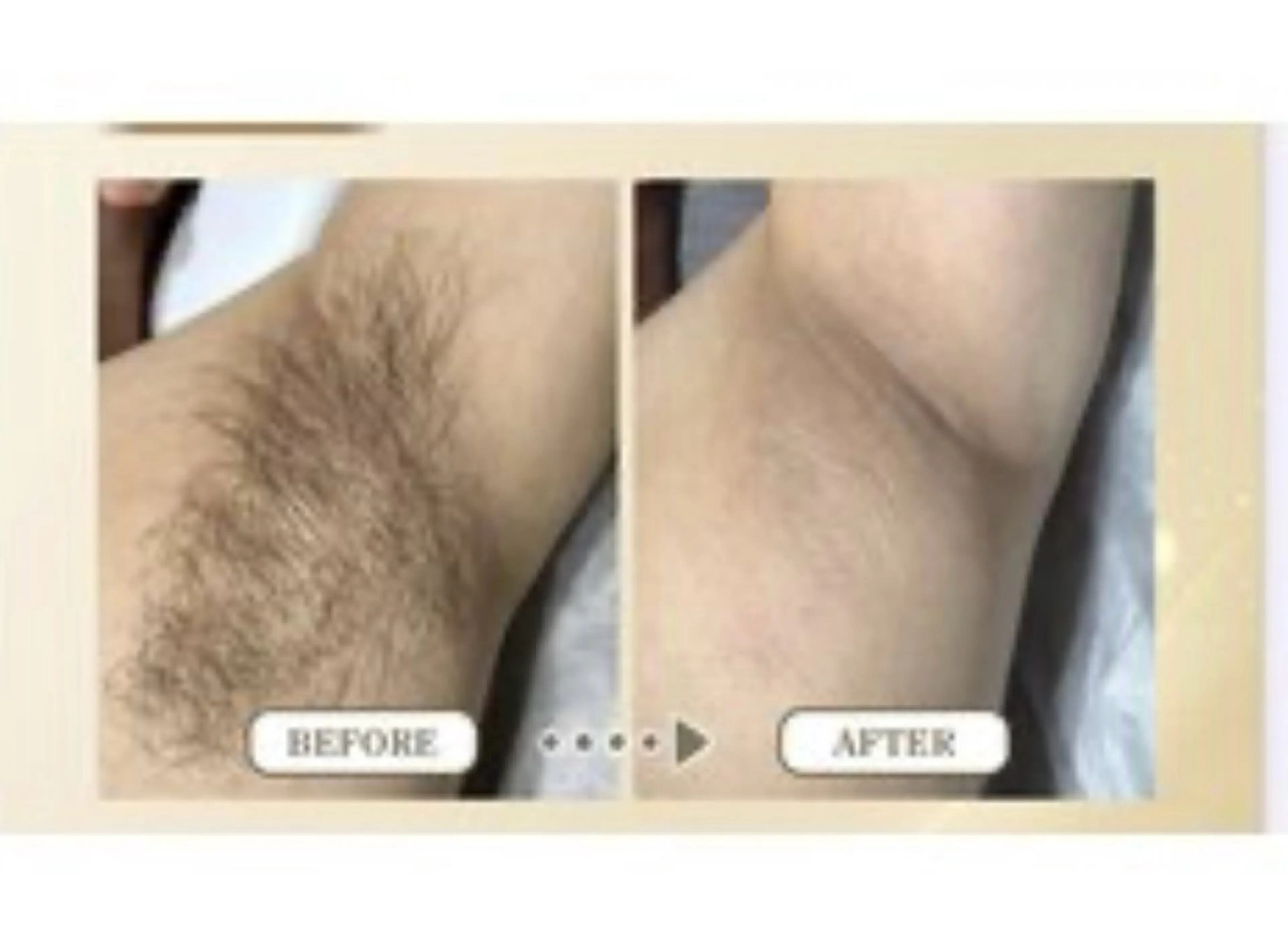 脱毛 メンズ脱毛サロン　SEAK所属・川口 孝のエステ・リラクイメージ