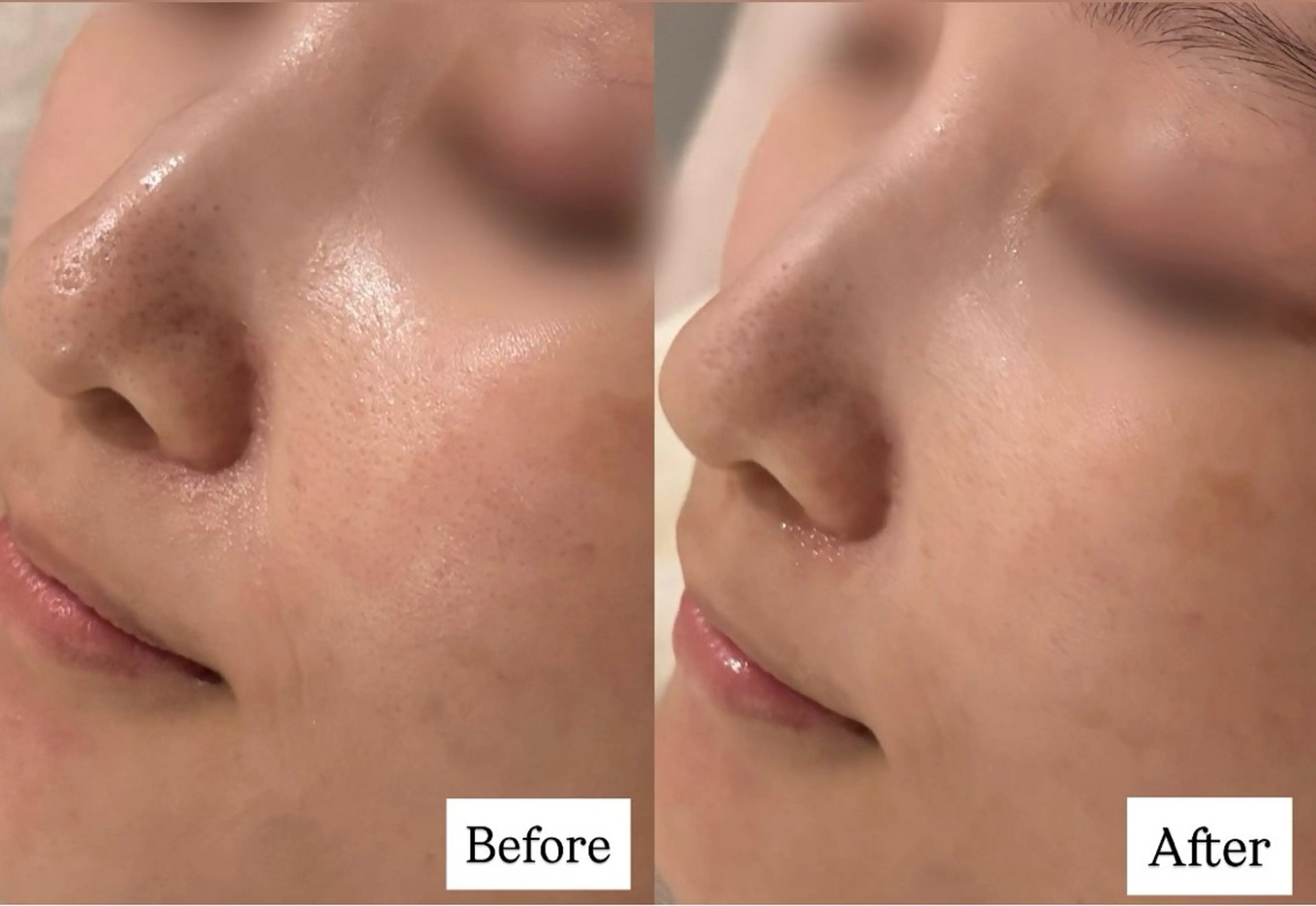 POLA 大阪福島店所属・POLA 大阪福島店のエステ・リラクイメージ