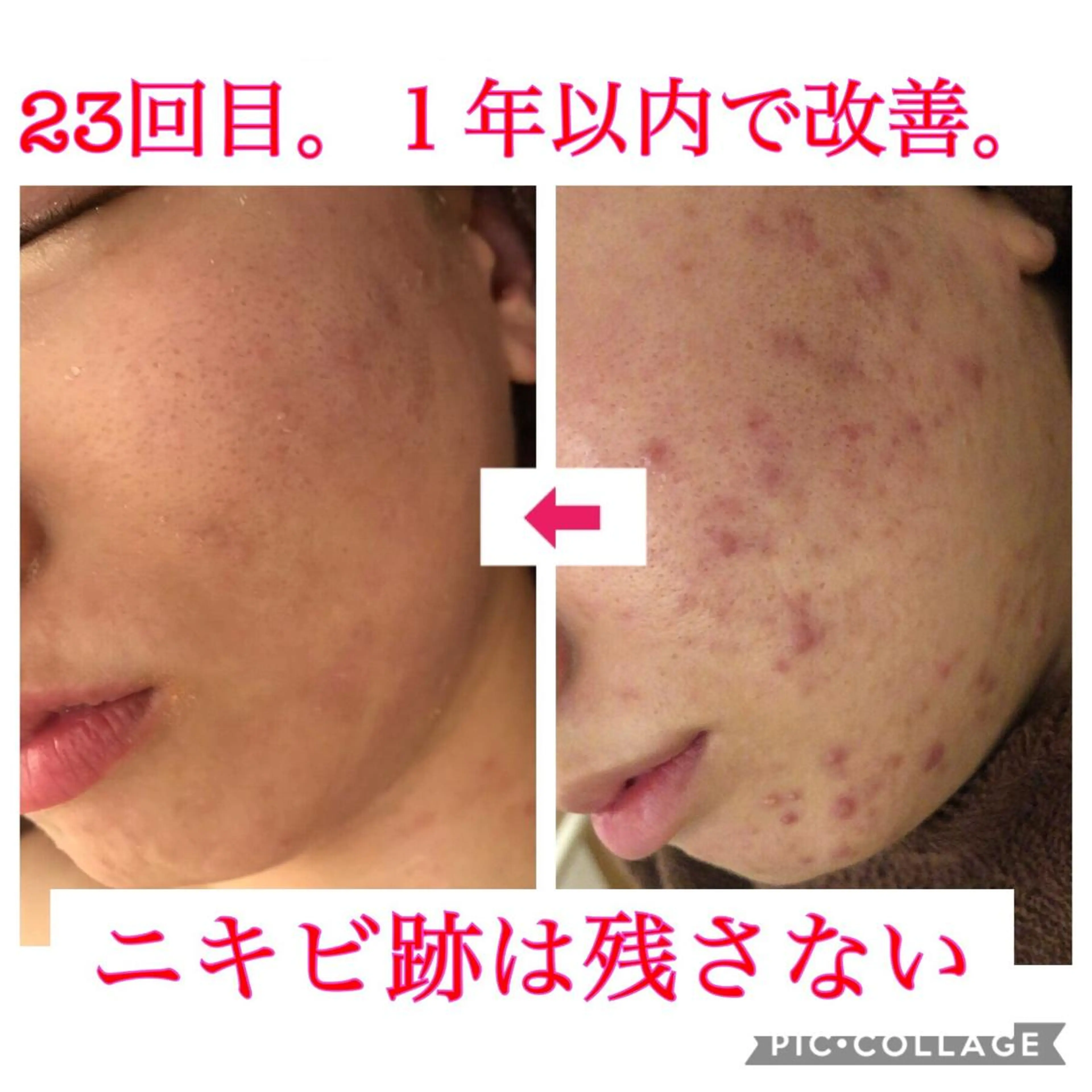 ミディアム カラー パーマ ヘアアレンジ メンズ キッズ ネイル マツエク・マツパ エステ リラク 四つ星サロン🎖 腸＆ニキビケアに特化のエステ・リラクイメージ