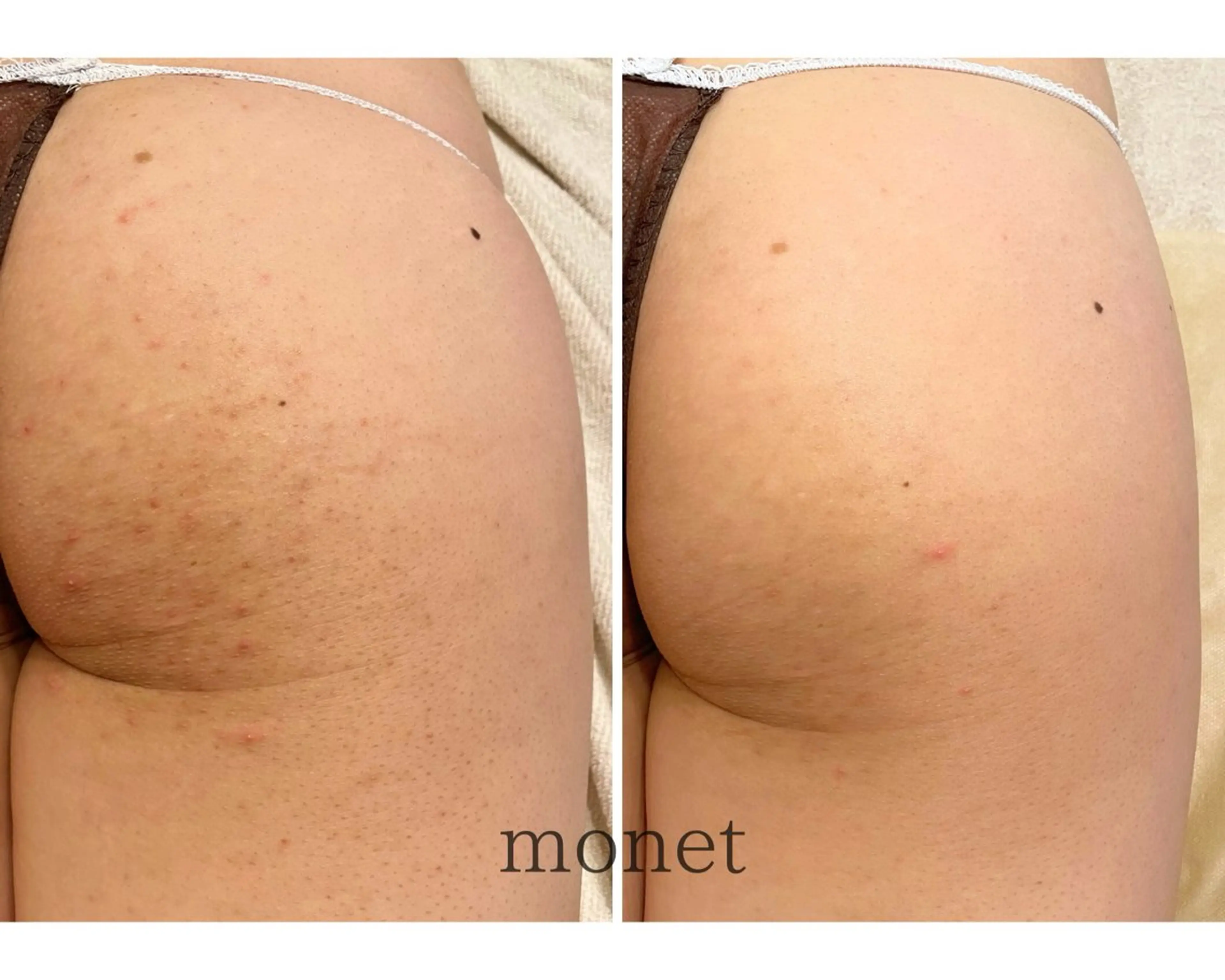 肌質改善🌿 彩也乃のエステ・リラクイメージ