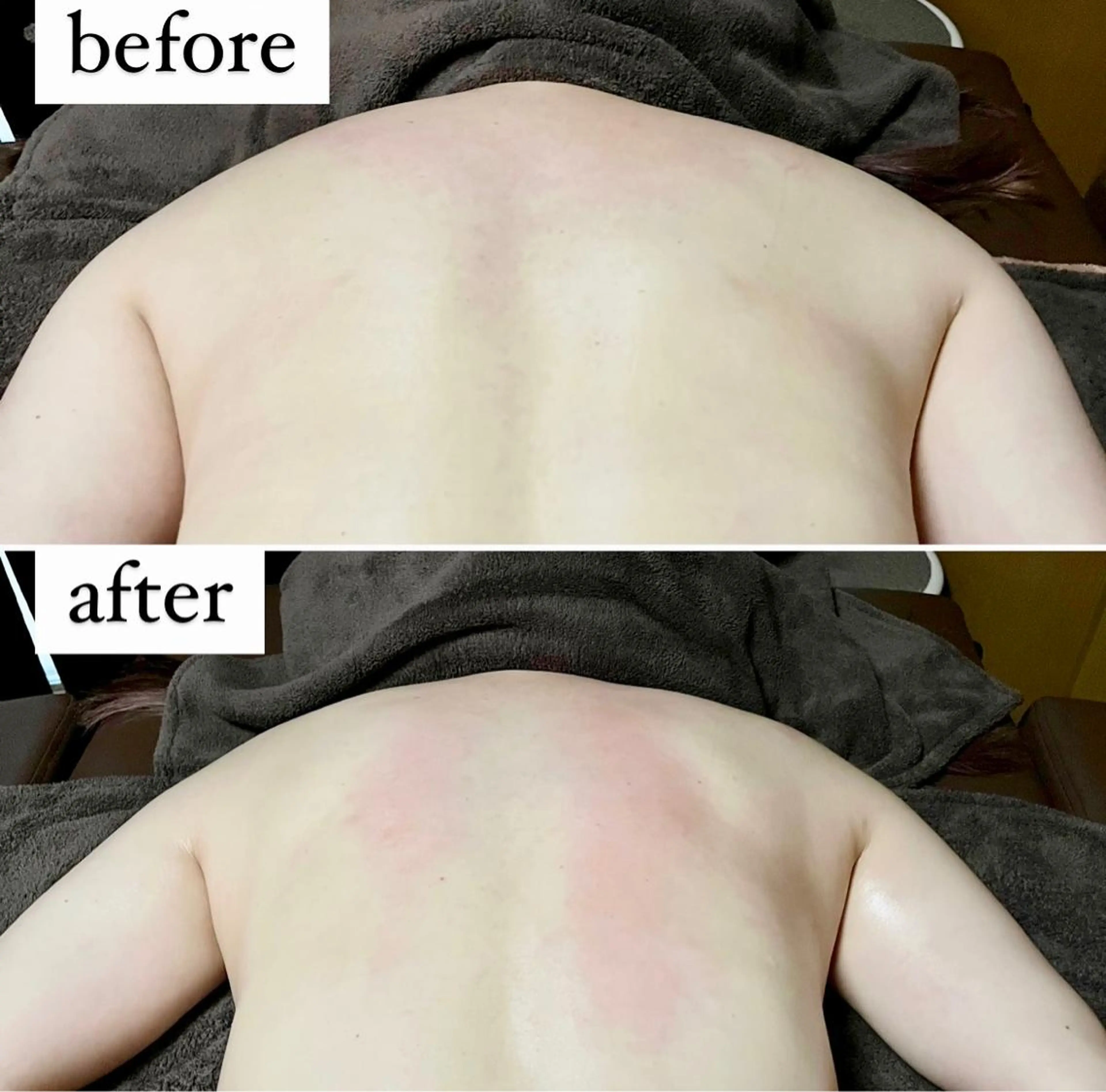 アイカワールド所属・鈴木 愛加のエステ・リラクイメージ