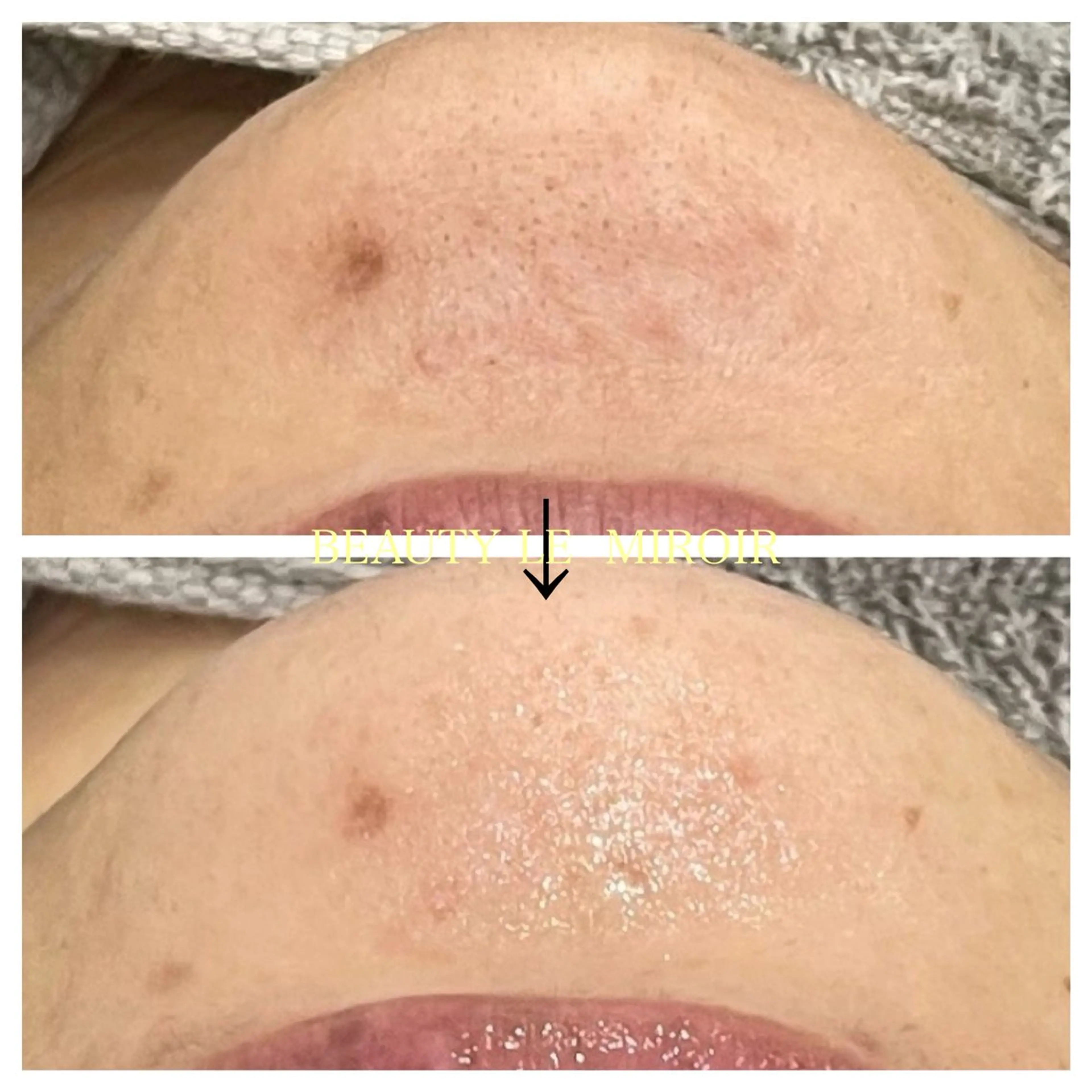 エステ ビューティー ミロワールのエステ・リラクイメージ