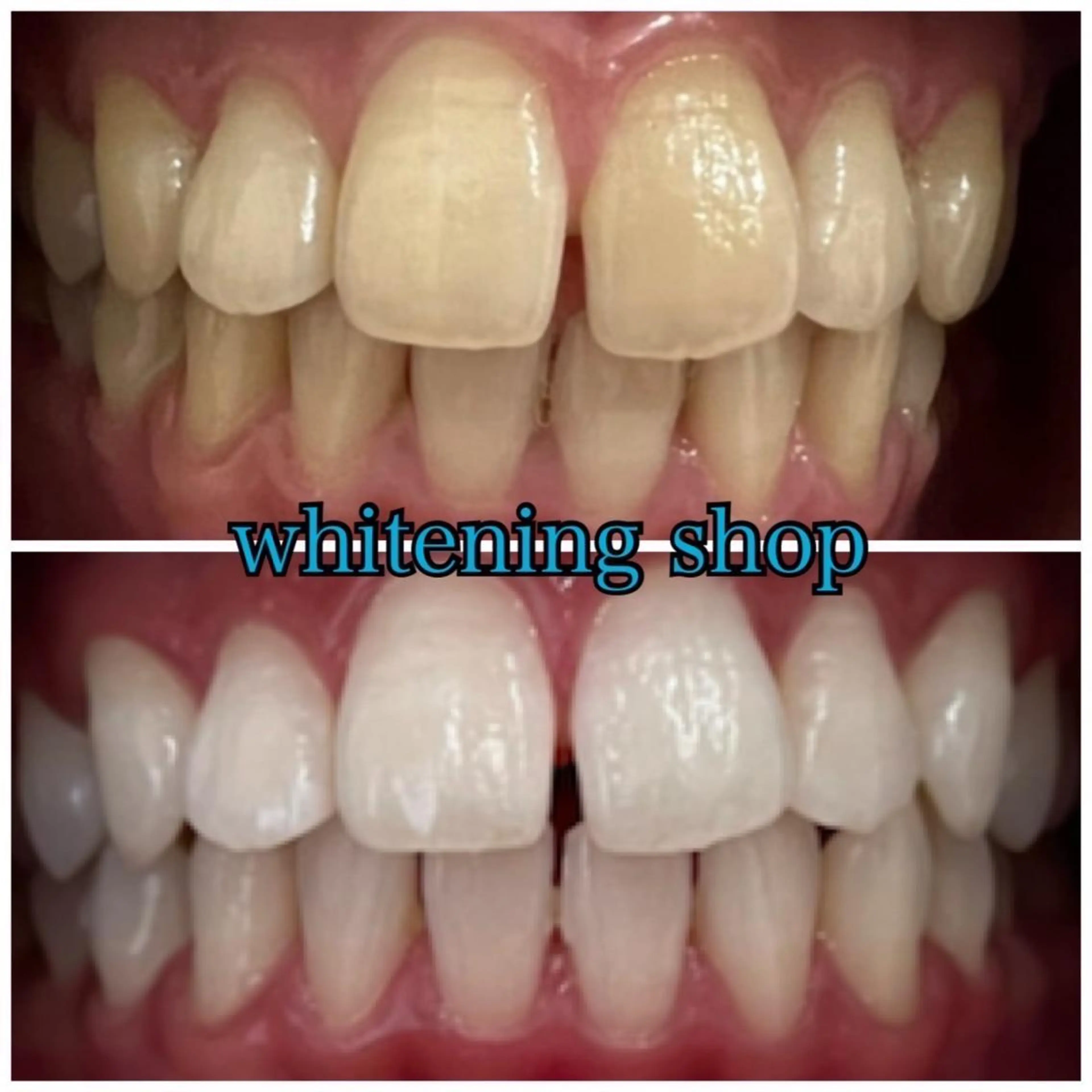 メンズ エステ リラク ホワイトニング ショップ船橋2号店のエステ・リラクイメージ