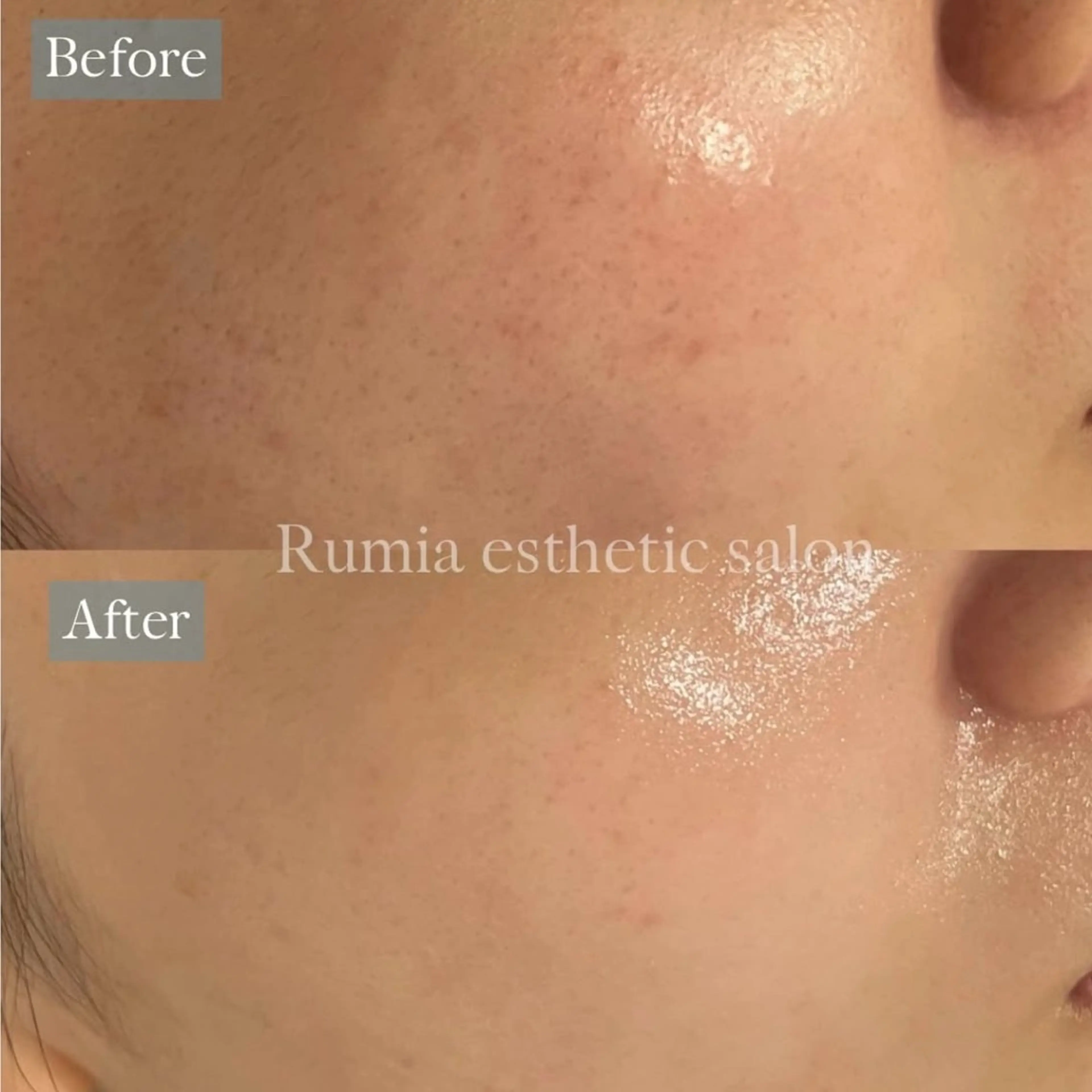 エステ Rumia Salonのエステ・リラクイメージ