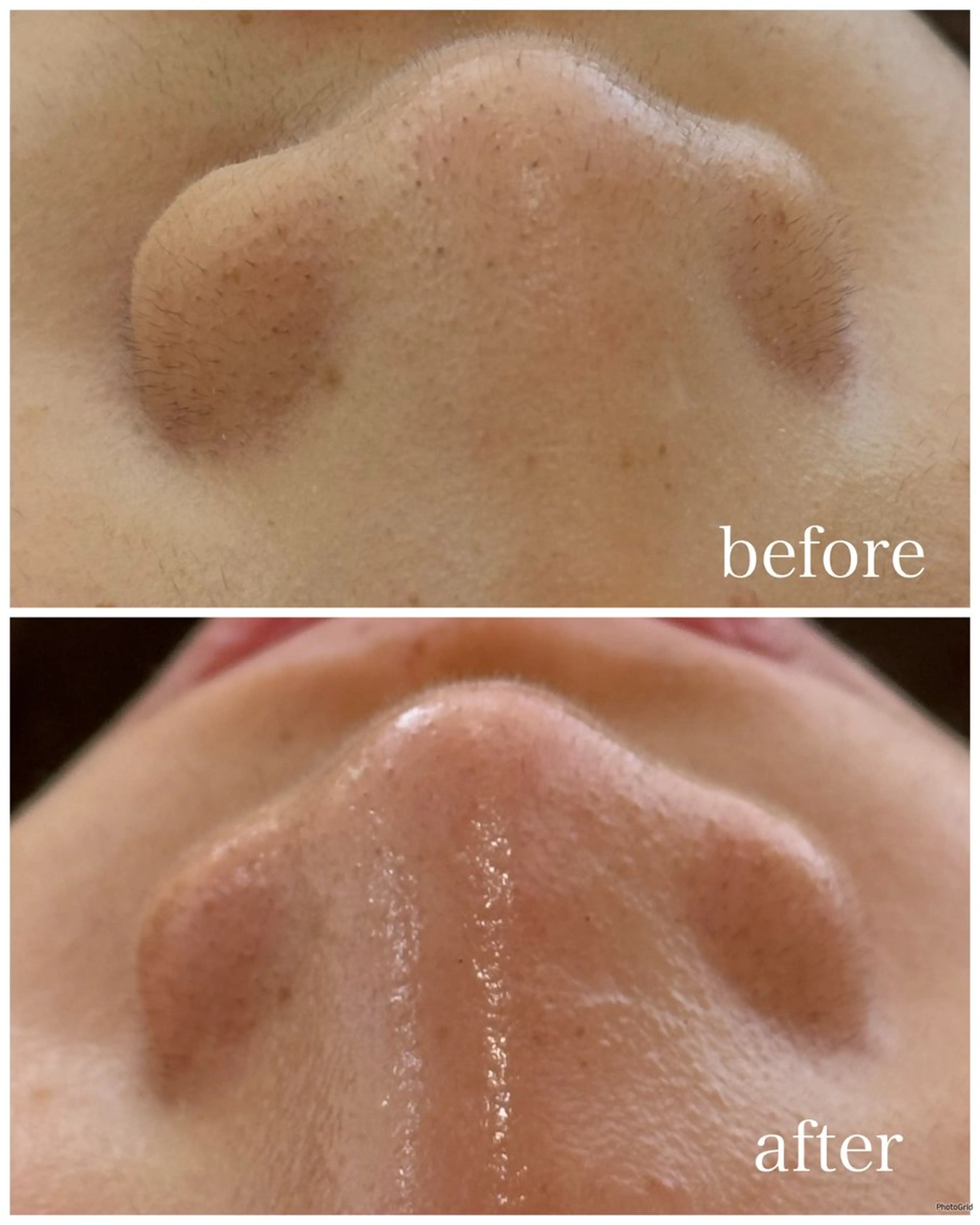 エステ écla【中崎町】 yukikoのエステ・リラクイメージ