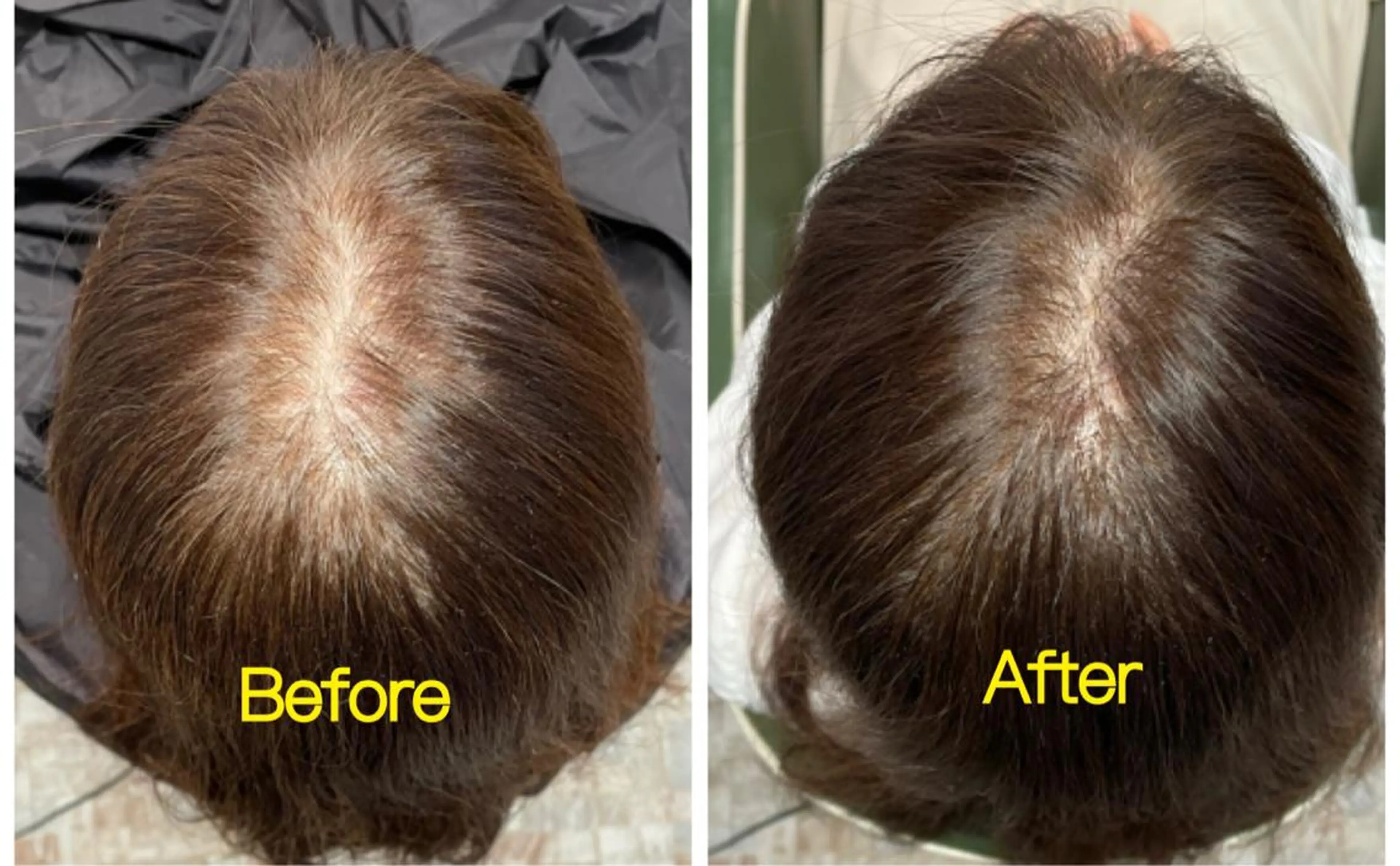 ヘアアレンジ Kanal Kanaのエステ・リラクイメージ