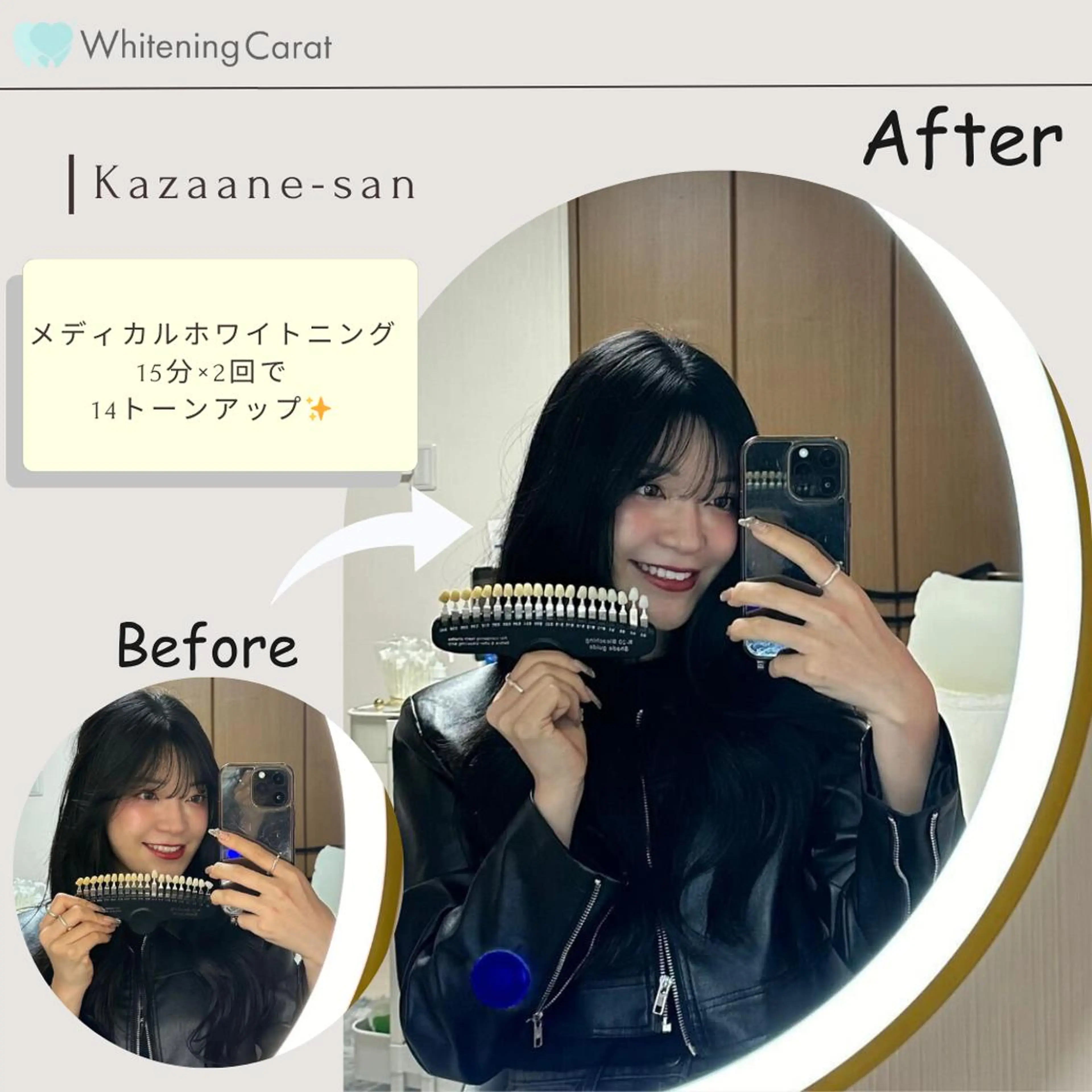 Whitening Carat 恵比寿店所属・ホワイトニング カラット 恵比寿店のエステ・リラクイメージ