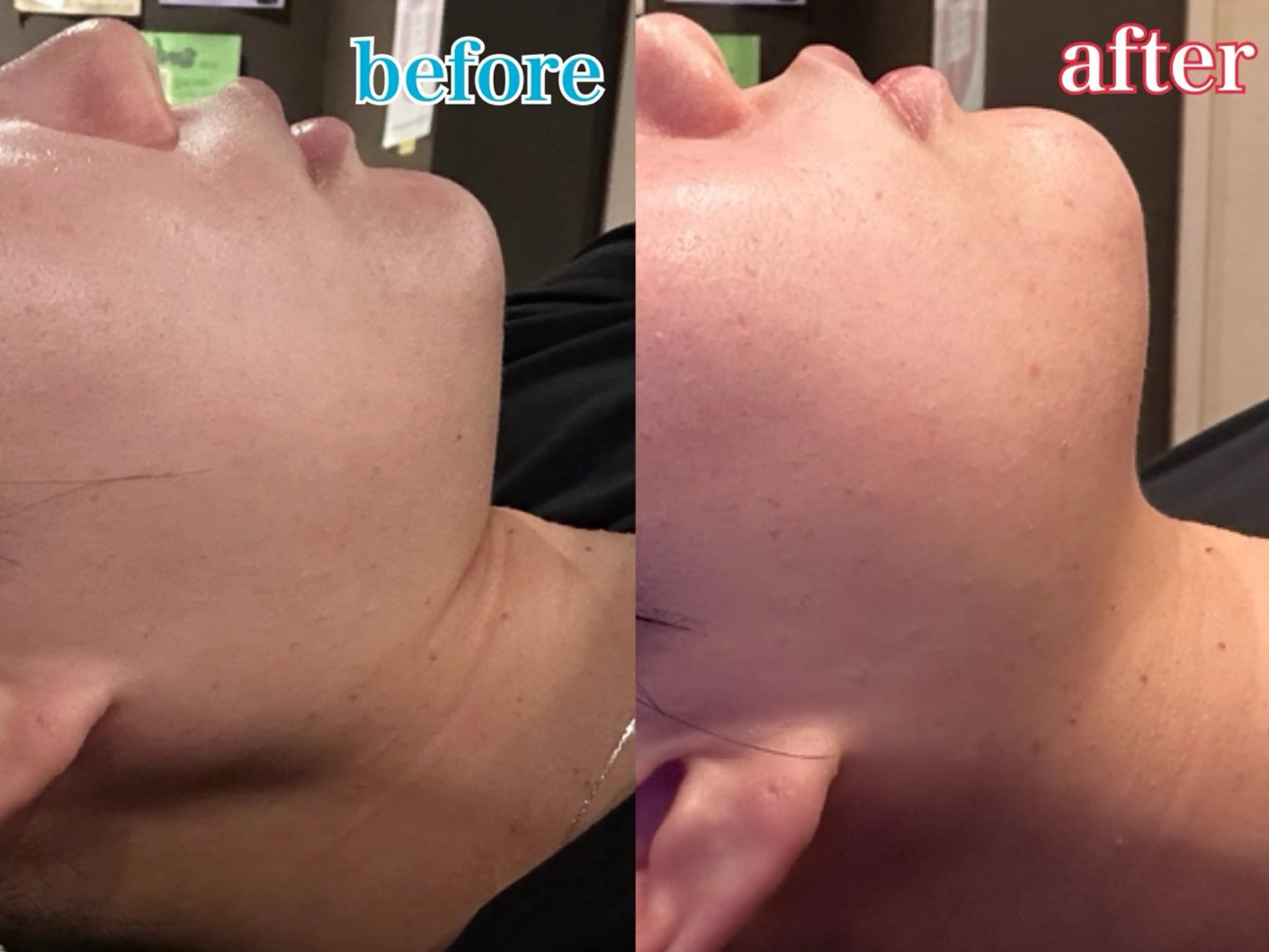 12月限定✨小顔超音波エステ｢プレゼント付き｣🩷の写真