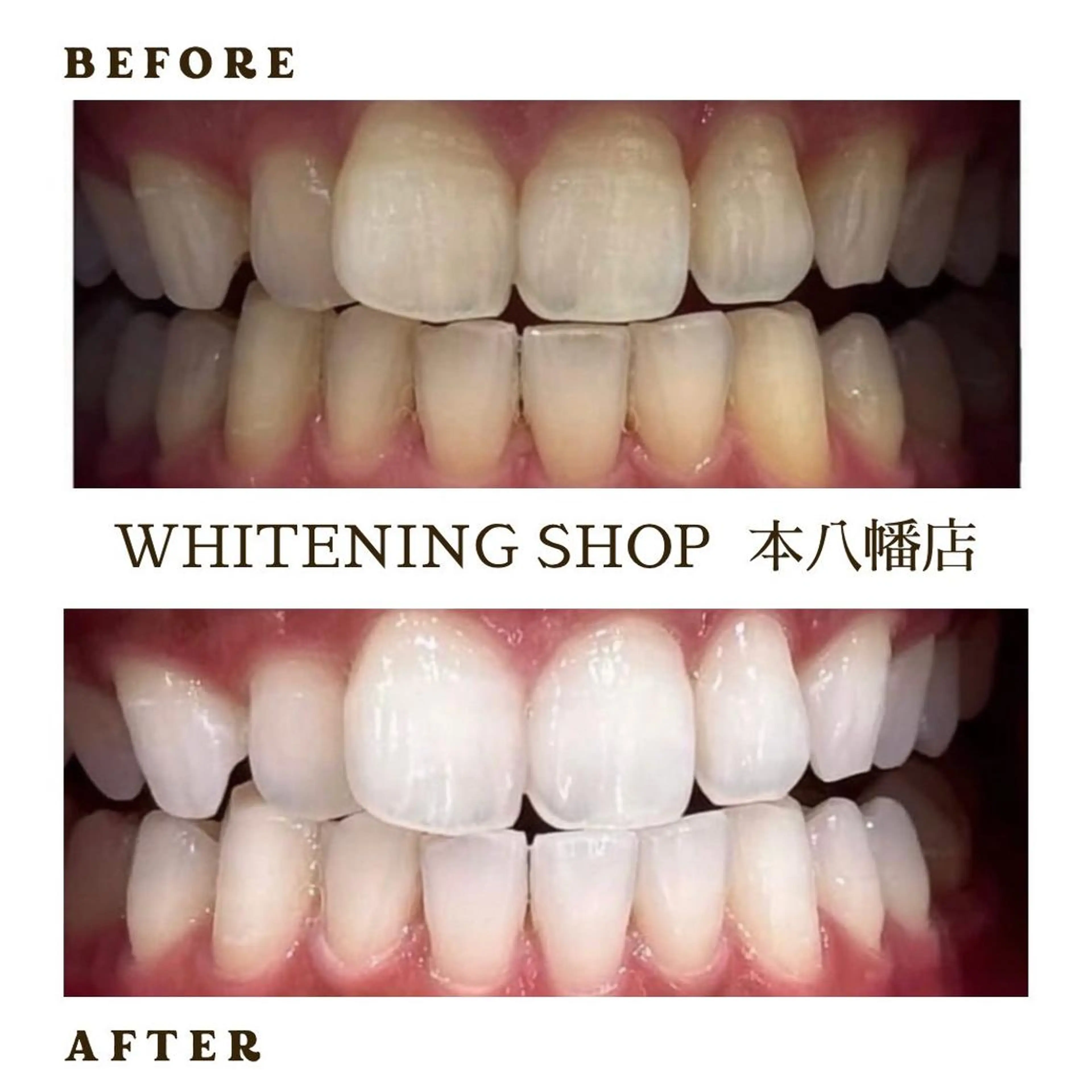 メンズ エステ リラク ホワイトニング ショップ本八幡店のエステ・リラクイメージ