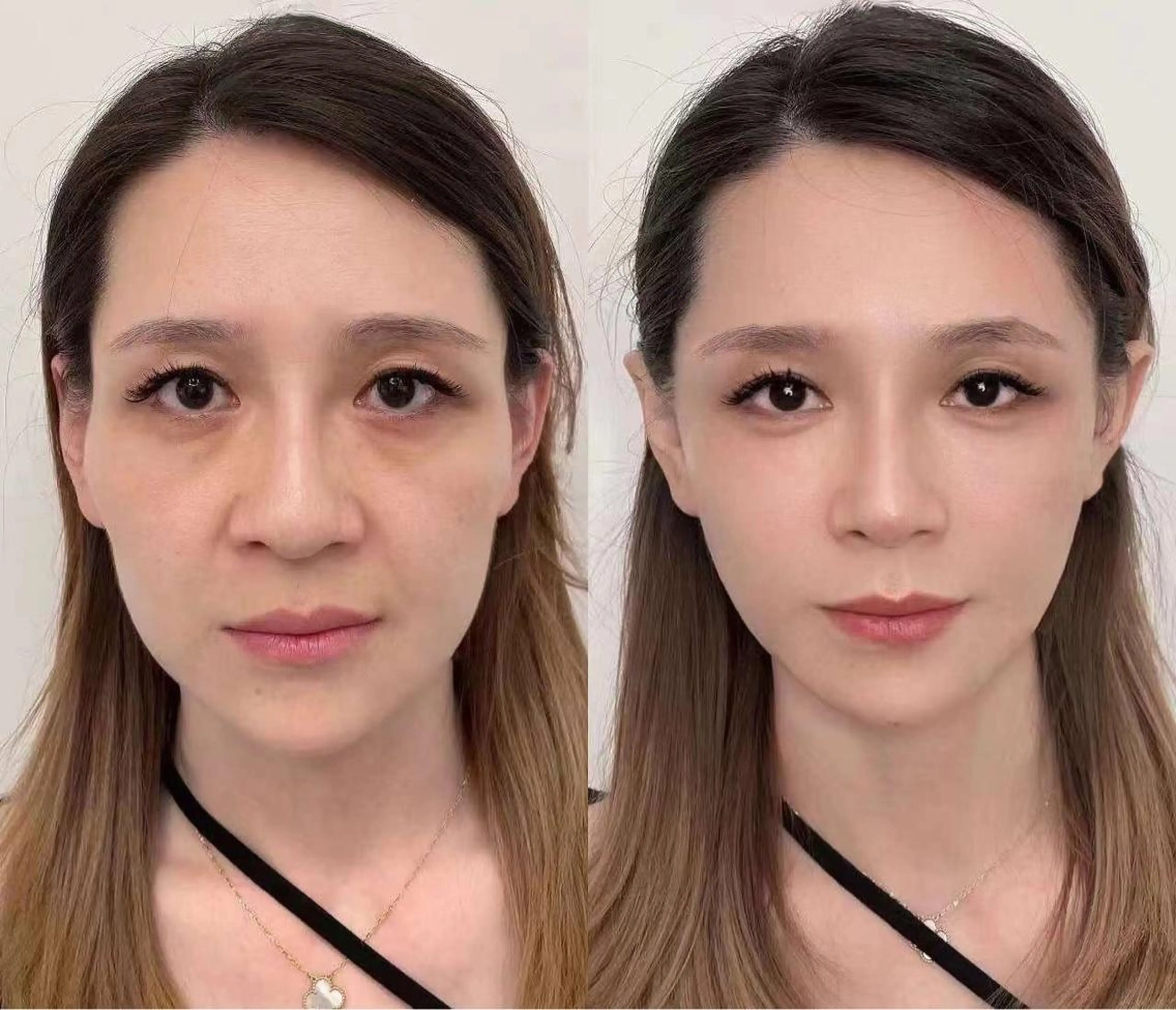 ネイル マツエク・マツパ ブルー 赤色 エステ aliaハイフ&水光ジェットサロン所属・aliaハーブ水光店 エステティシャン募集のエステ・リラクイメージ