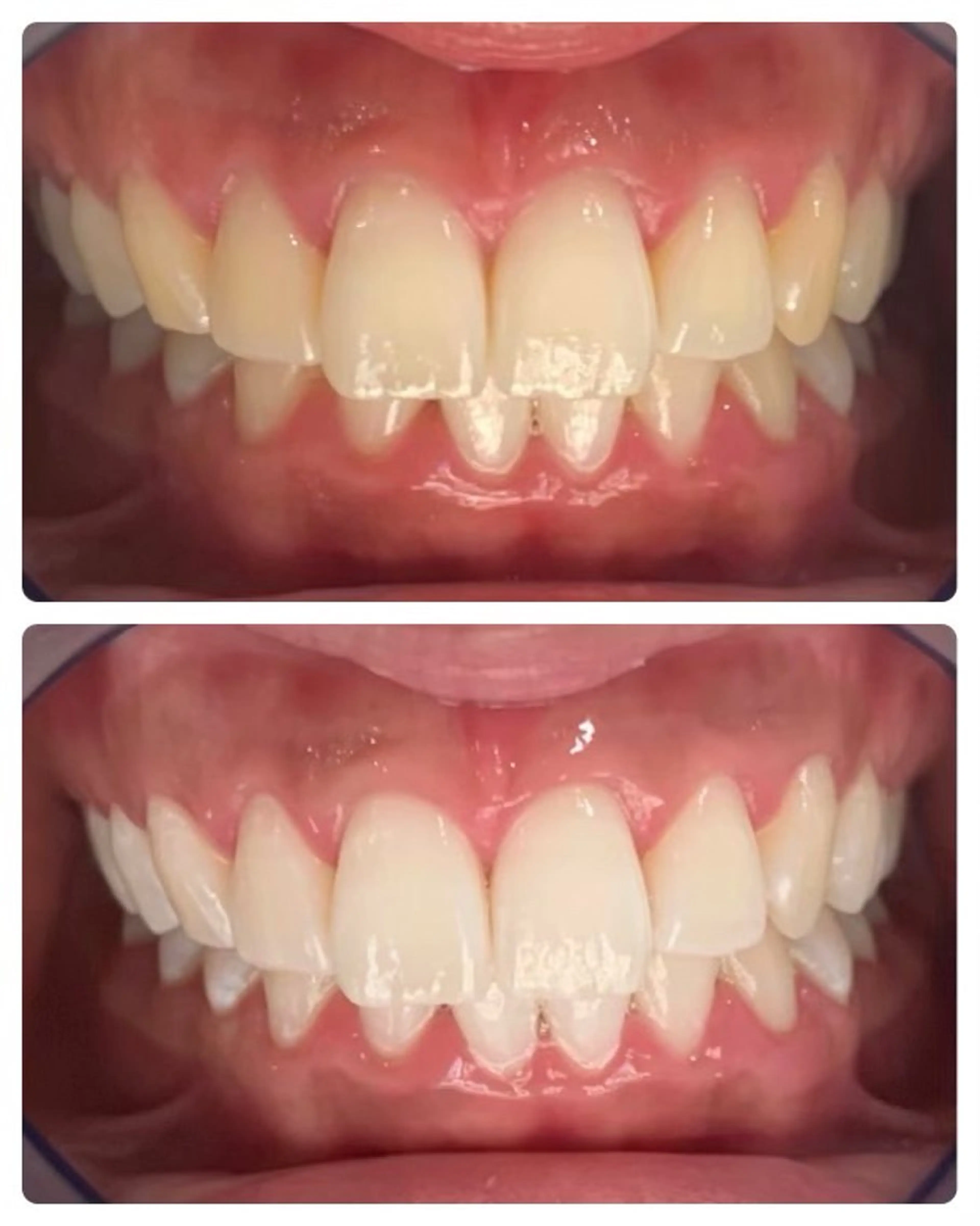 セルフホワイトニング サクッとホワイト   立川店所属・サクッとホワイト 立川店のその他イメージ