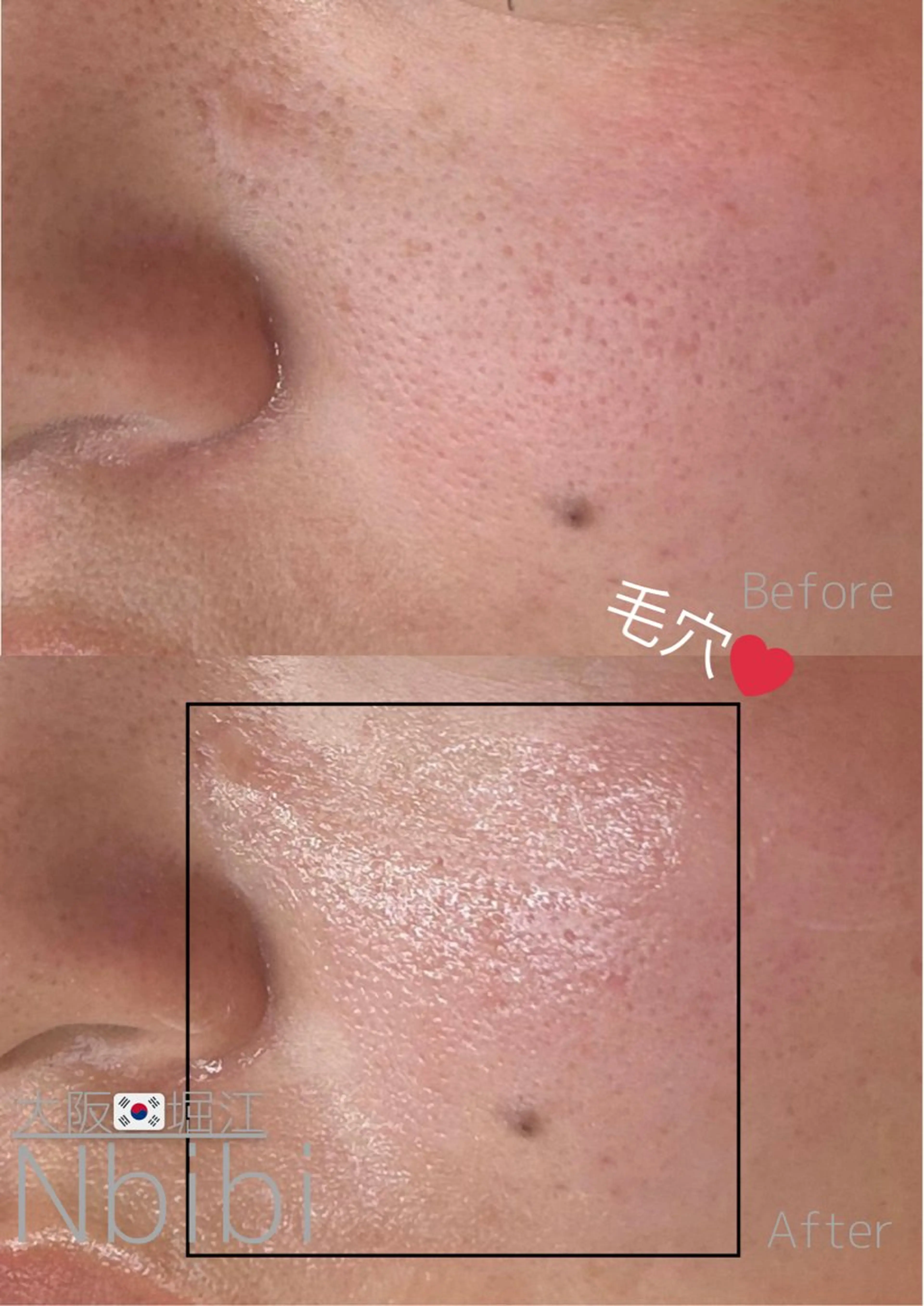 エステ 韓国🇰🇷価格 サロン_Nbibiのエステ・リラクイメージ