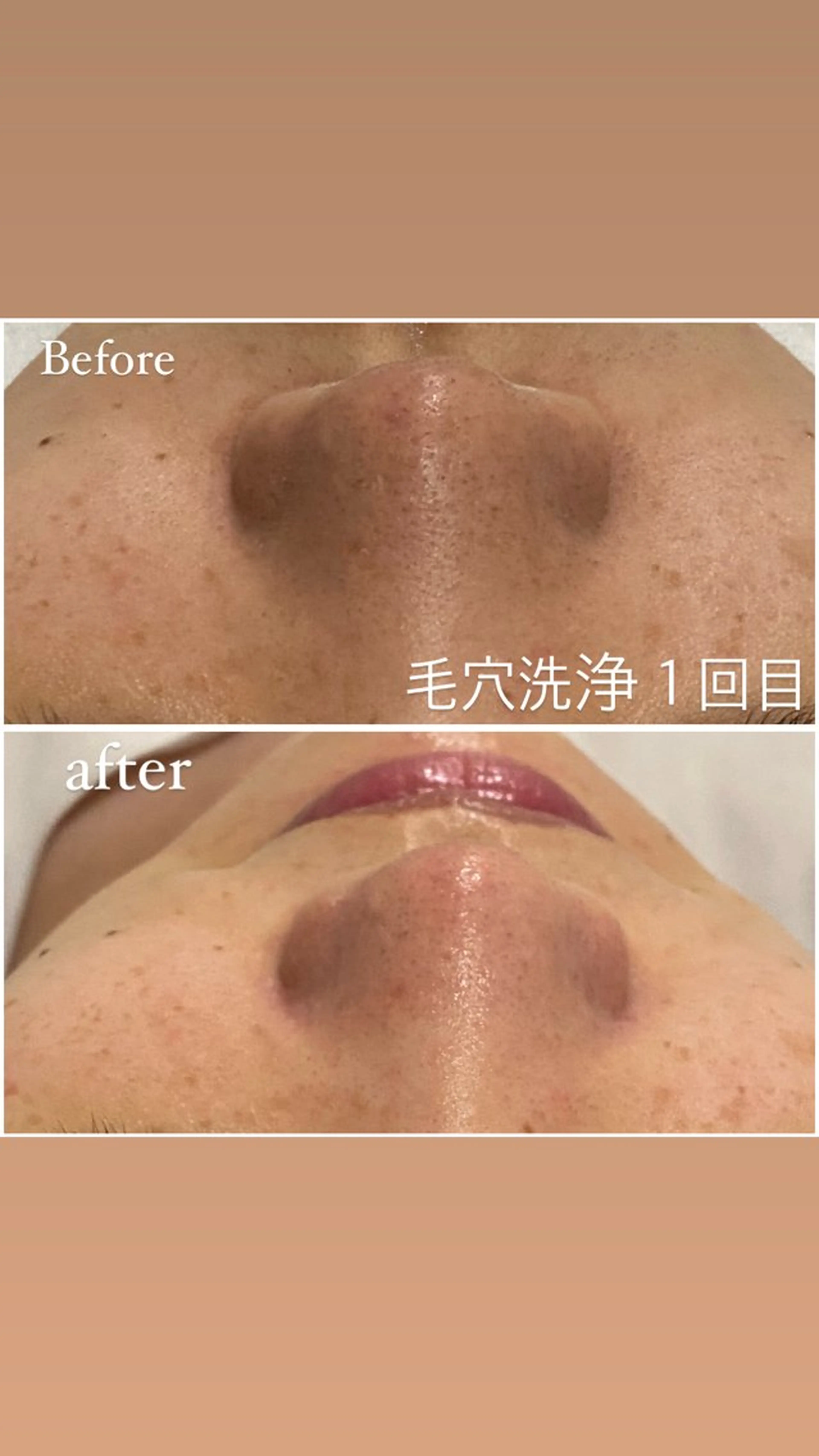 エステ 毛穴洗浄・痩身・脱毛 /アルカンジュのエステ・リラクイメージ