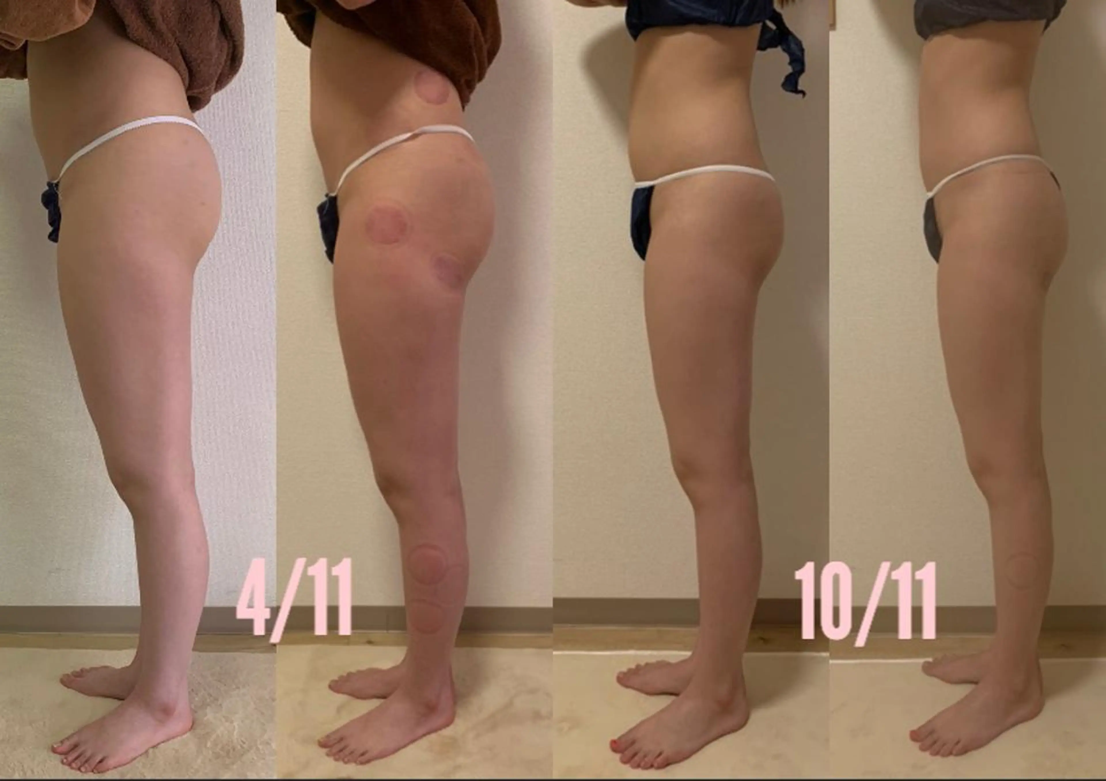 a  room salonのエステ・リラクイメージ