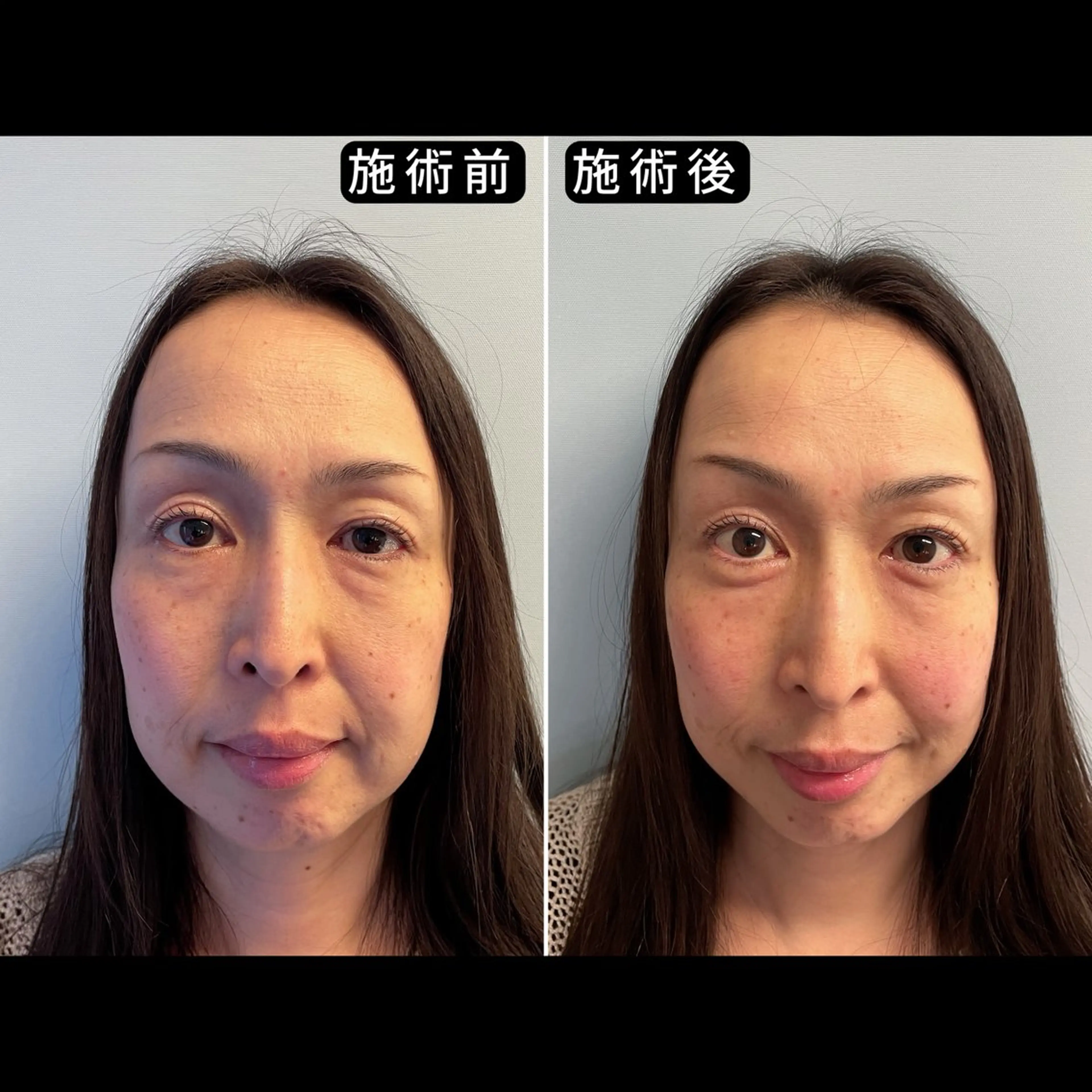 渋谷 小顔美容鍼 専門サロン YZのエステ・リラクイメージ