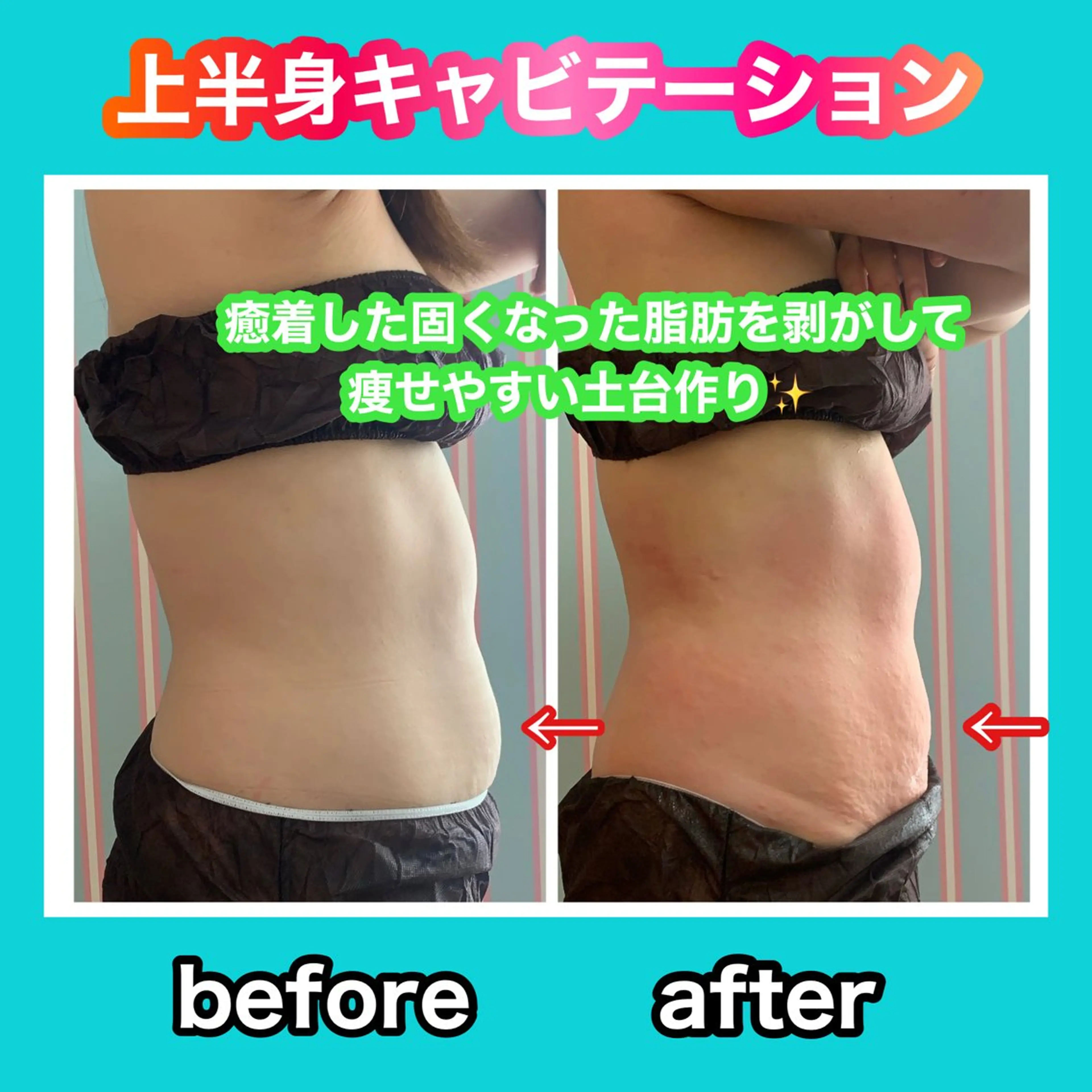 エステ リラク 痩身/脱毛/ネイル HARUKAのエステ・リラクイメージ