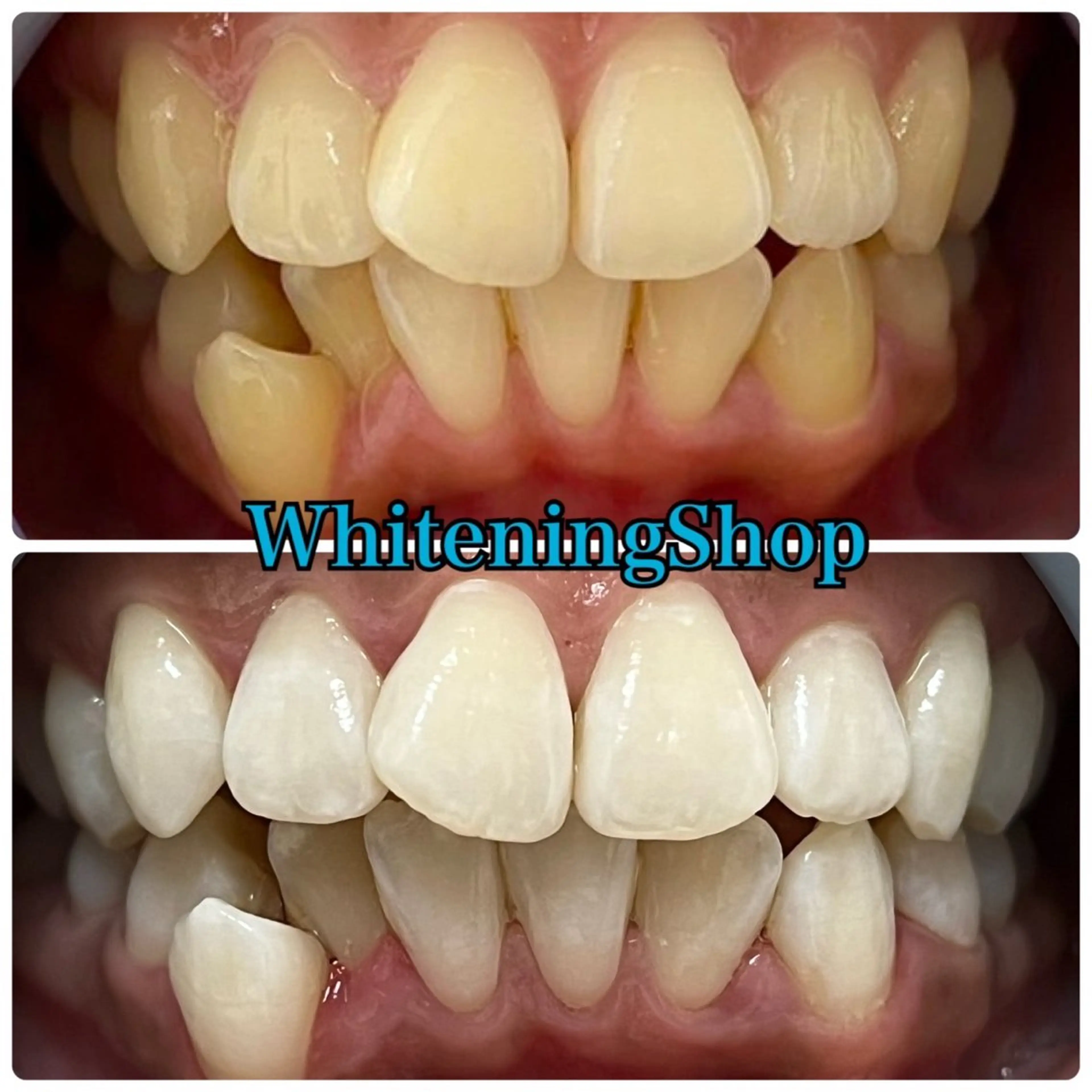 ホワイトニング ショップ吉祥寺店のエステ・リラクイメージ