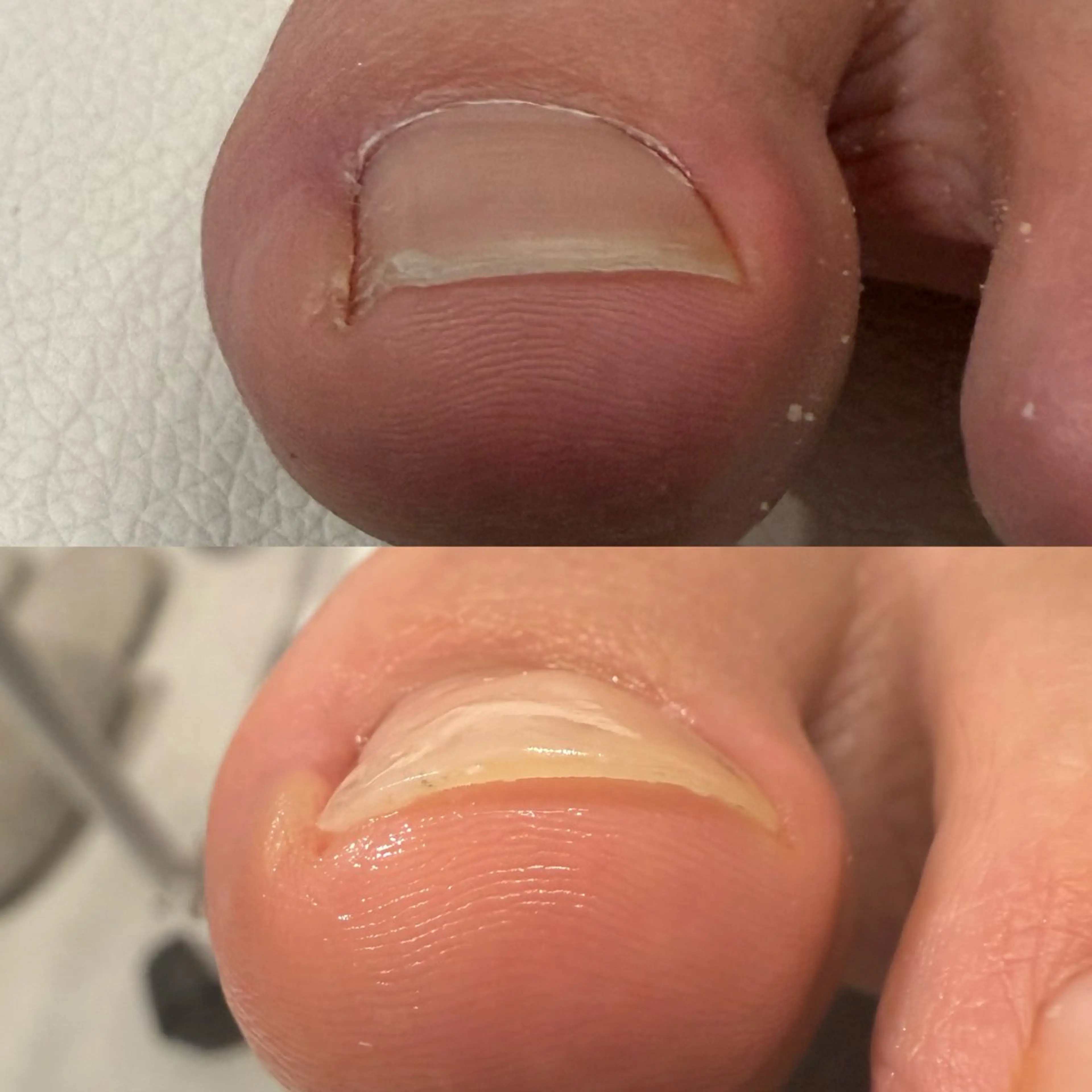 ネイル フットネイル その他(ネイル) ネイルケアサロン Campanulaのネイルデザイン